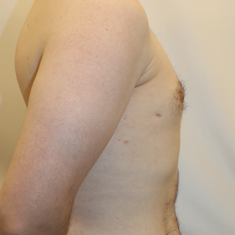 After Image