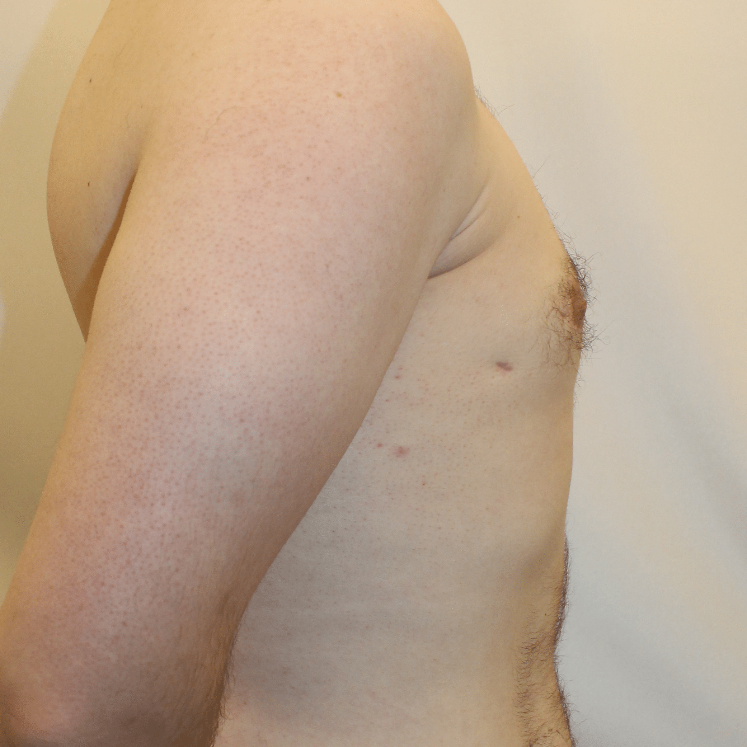 After Image:  - right-side