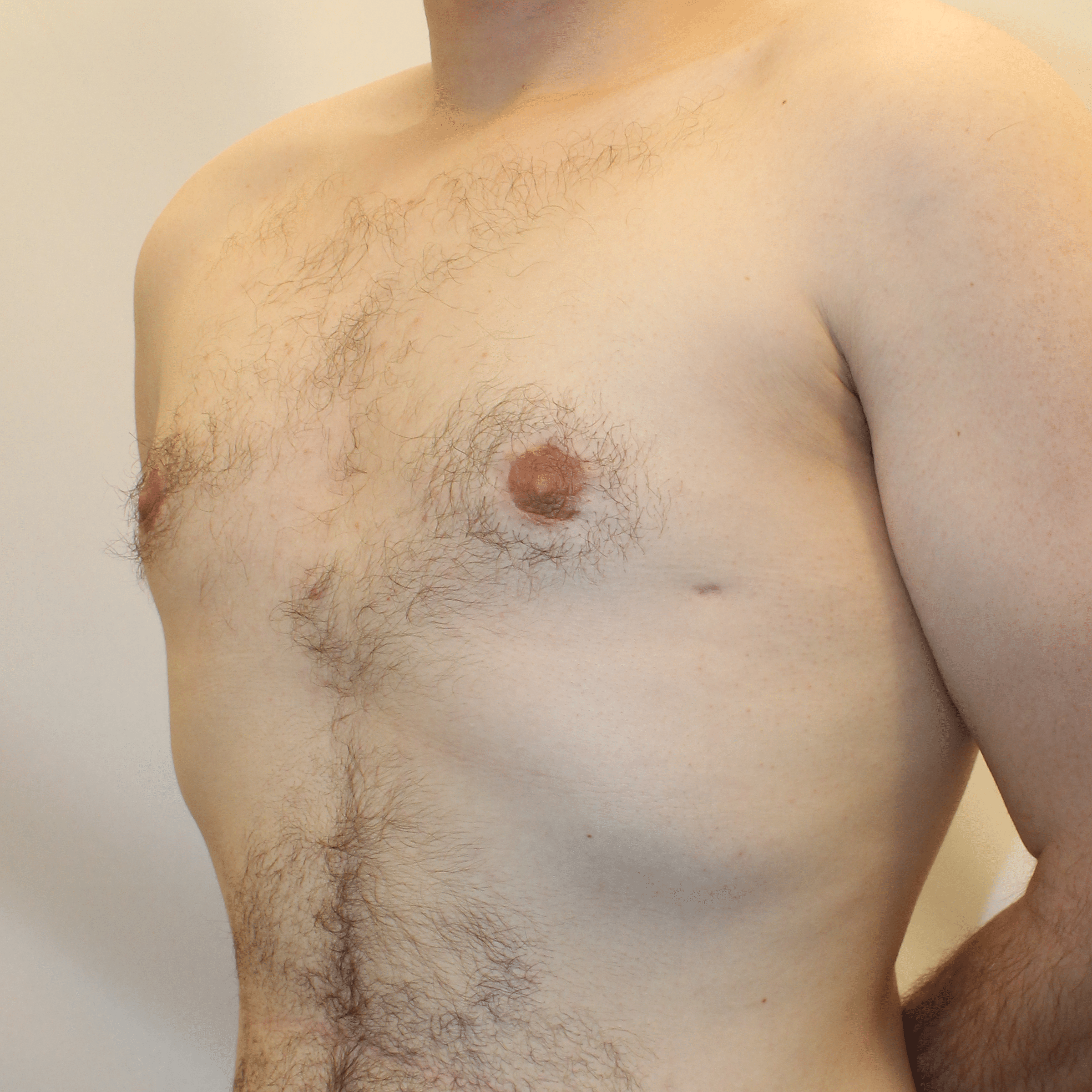 After Image:  - left-front-oblique