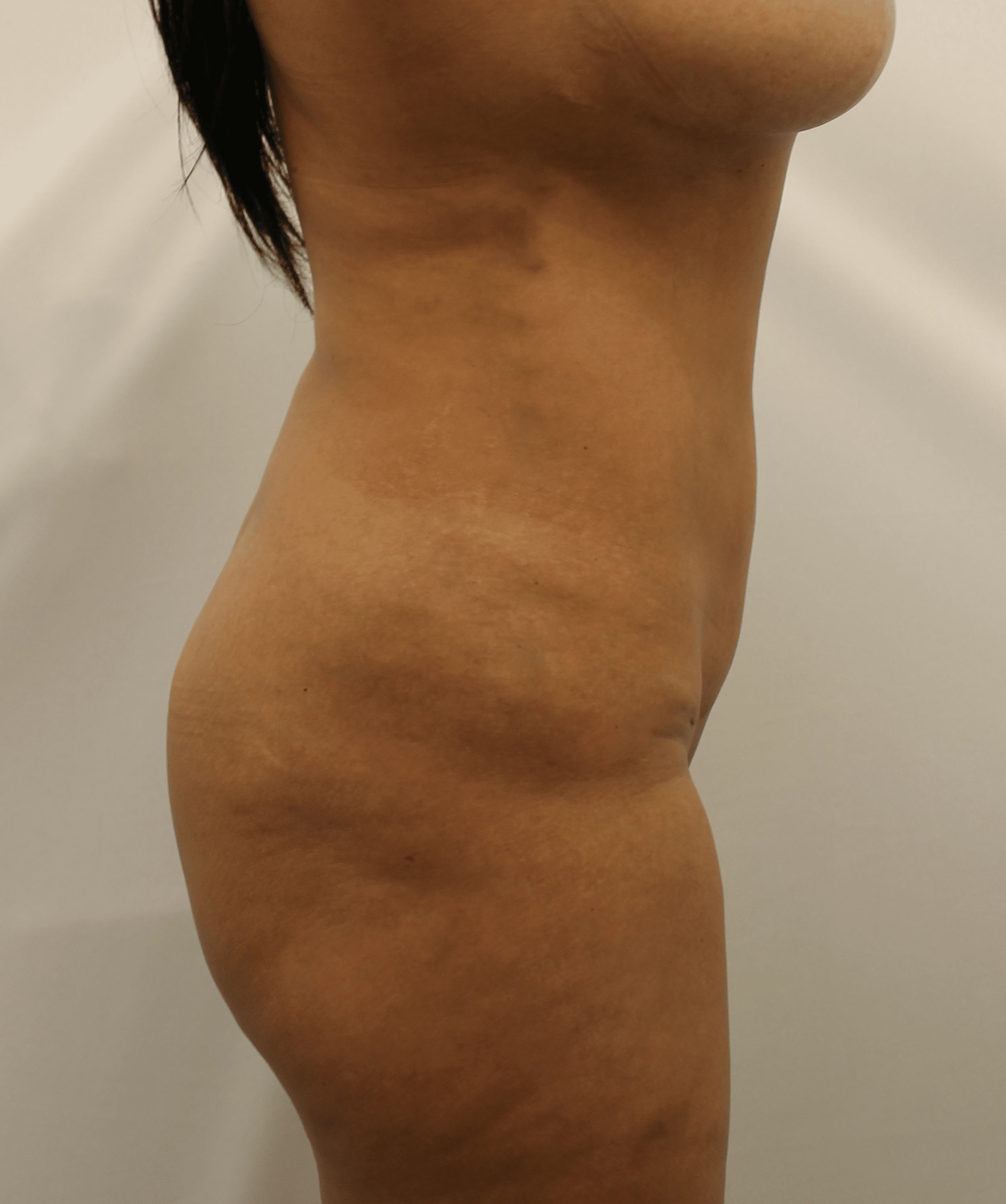 After Image:  - right-side