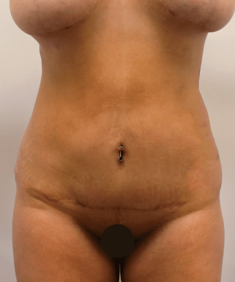 After Image