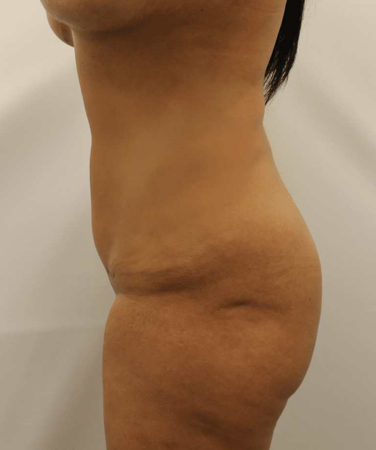 After Image
