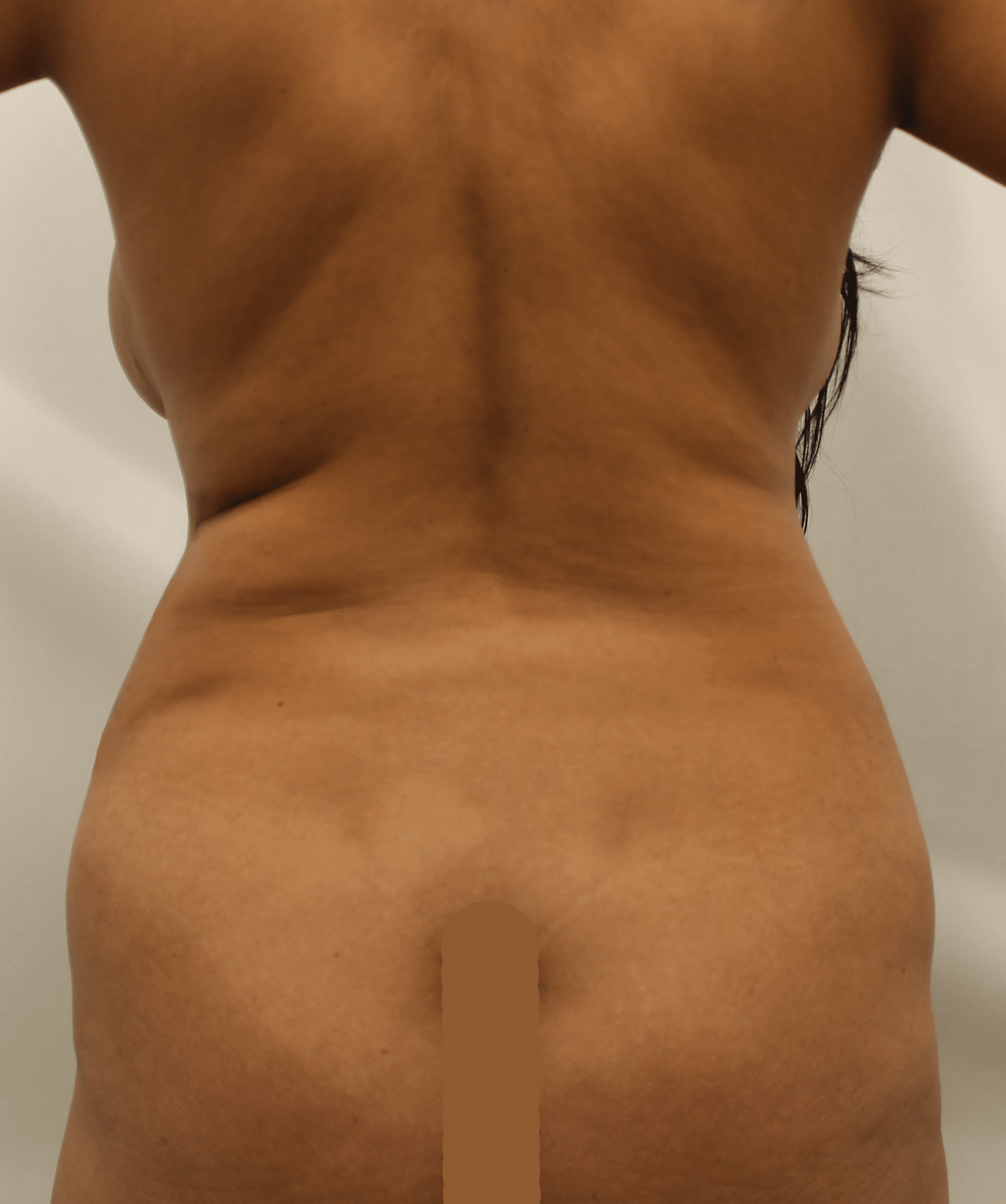 Before Image:  - back