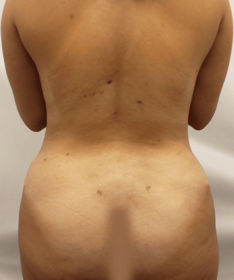 After Image