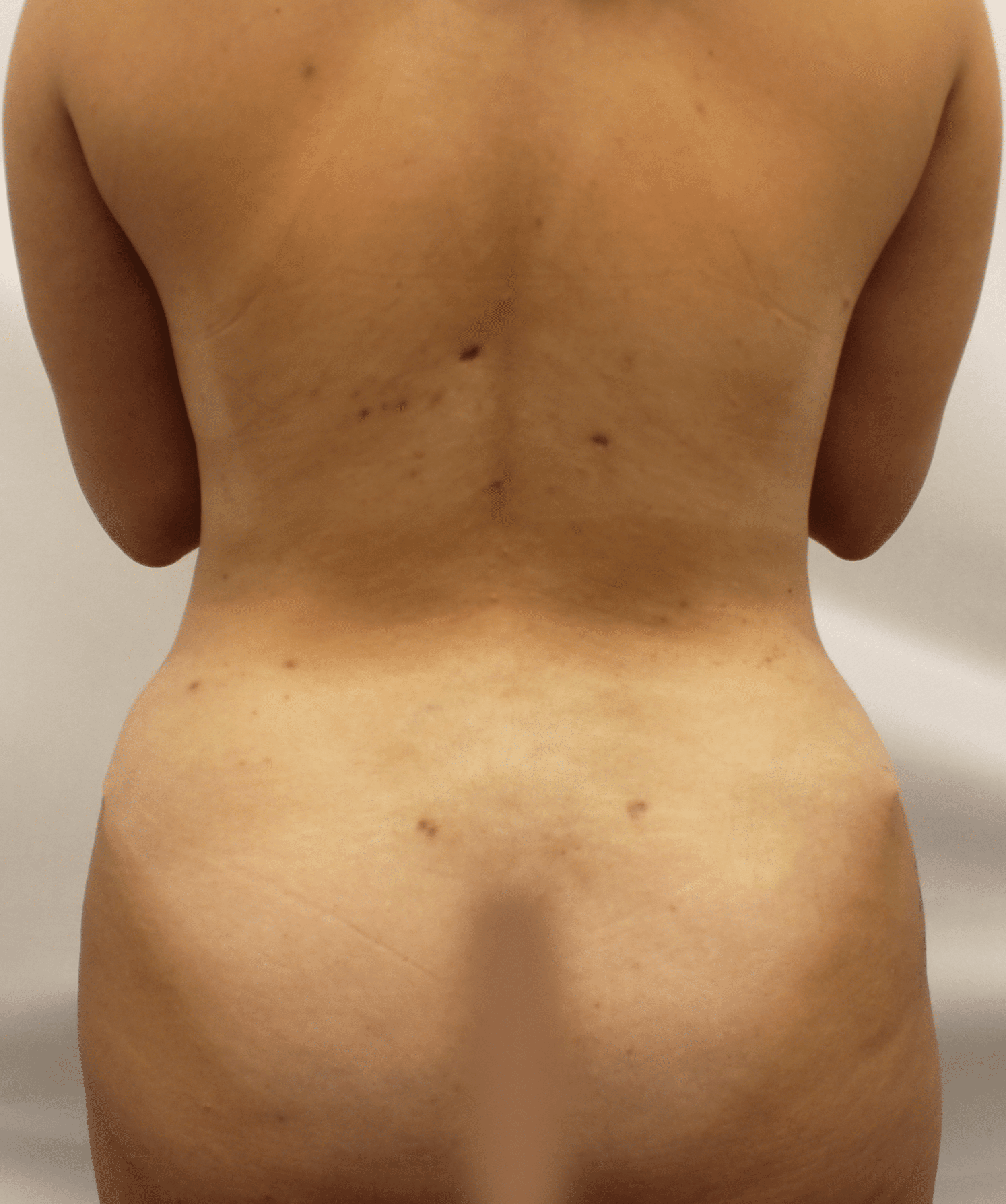 After Image:  - back