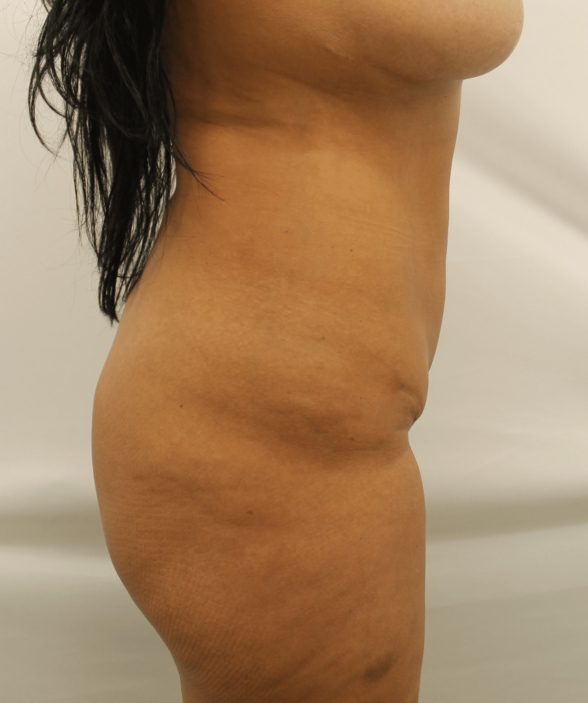 Before Image:  - right-side