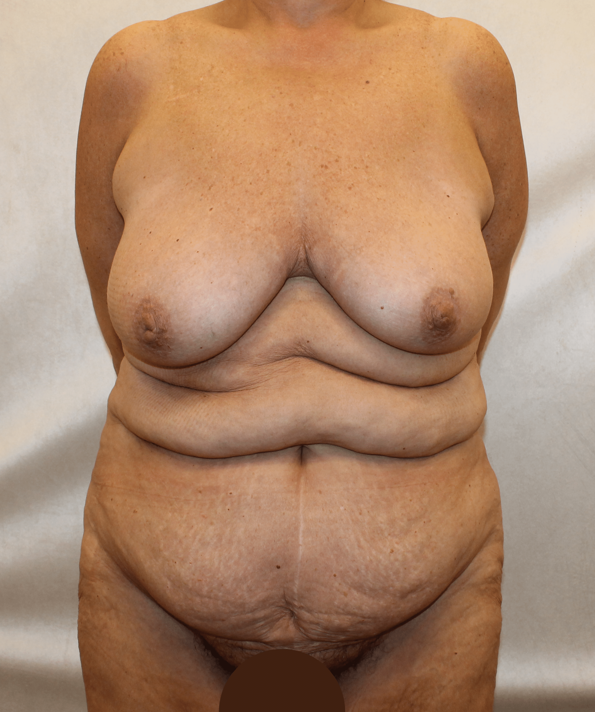 Before Image:  - front