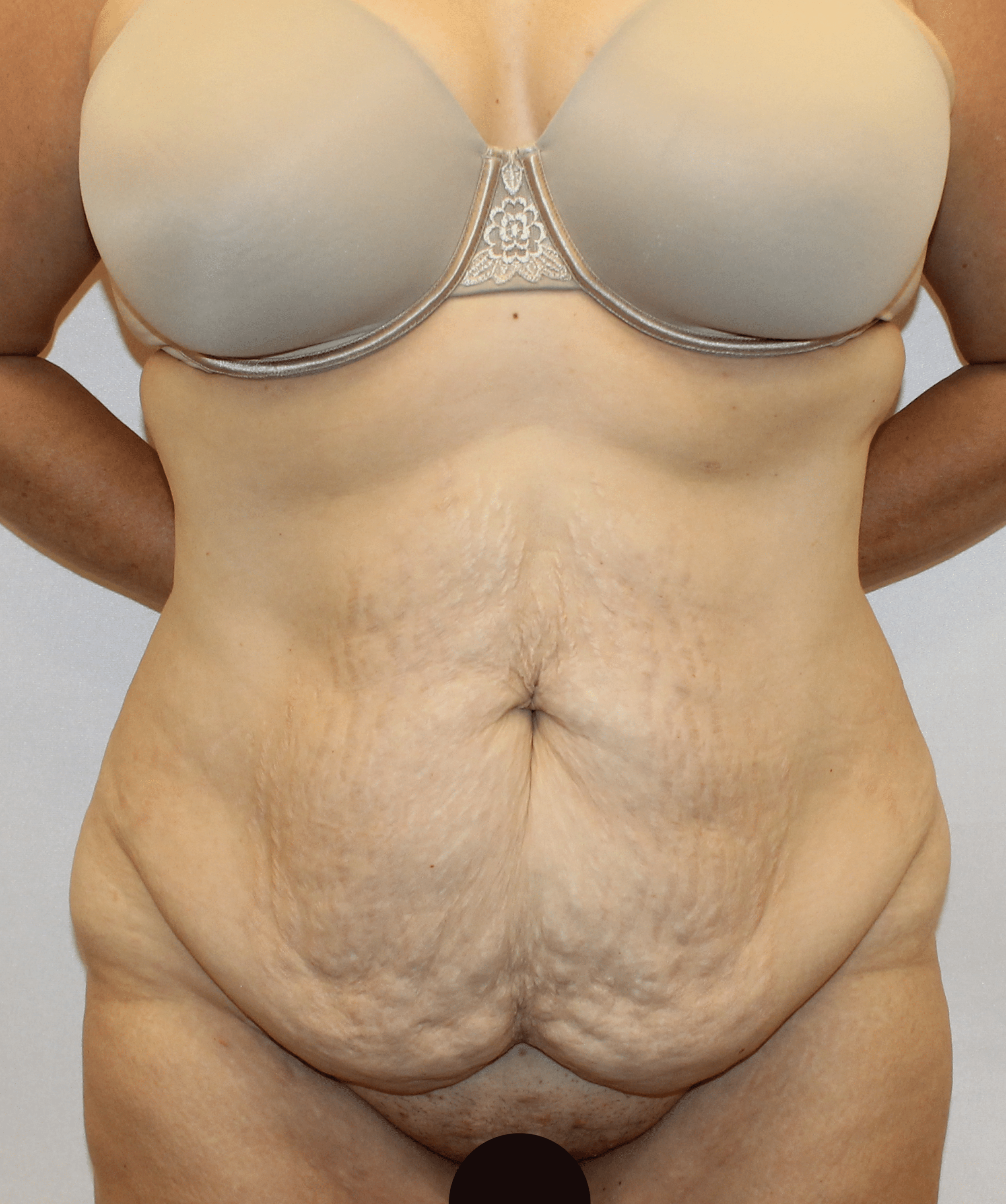 Before Image:  - front