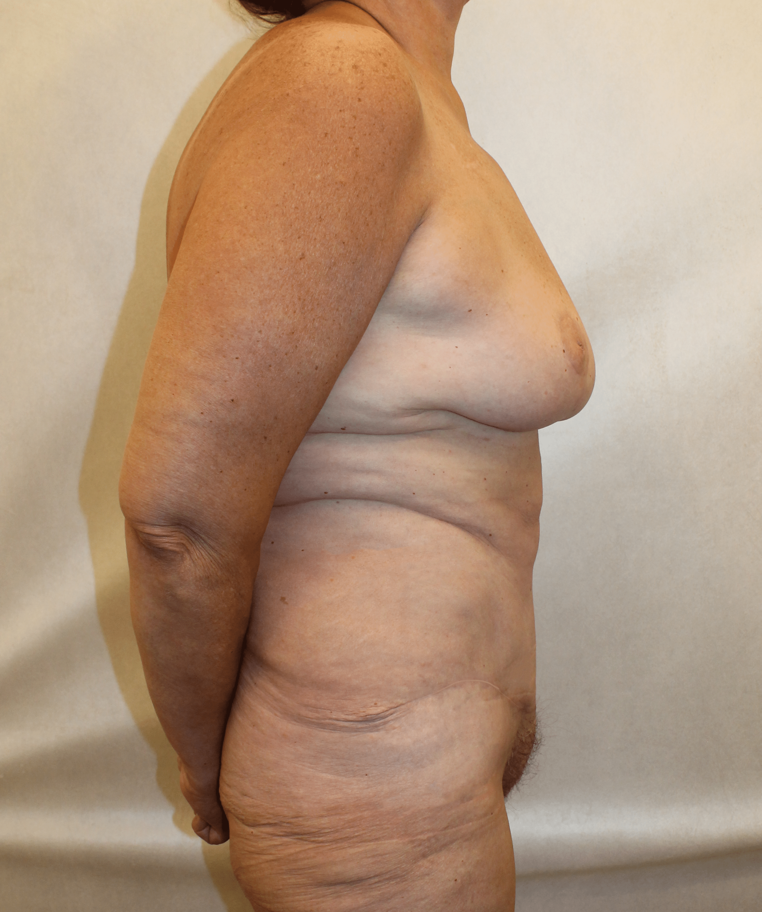 After Image:  - right-side