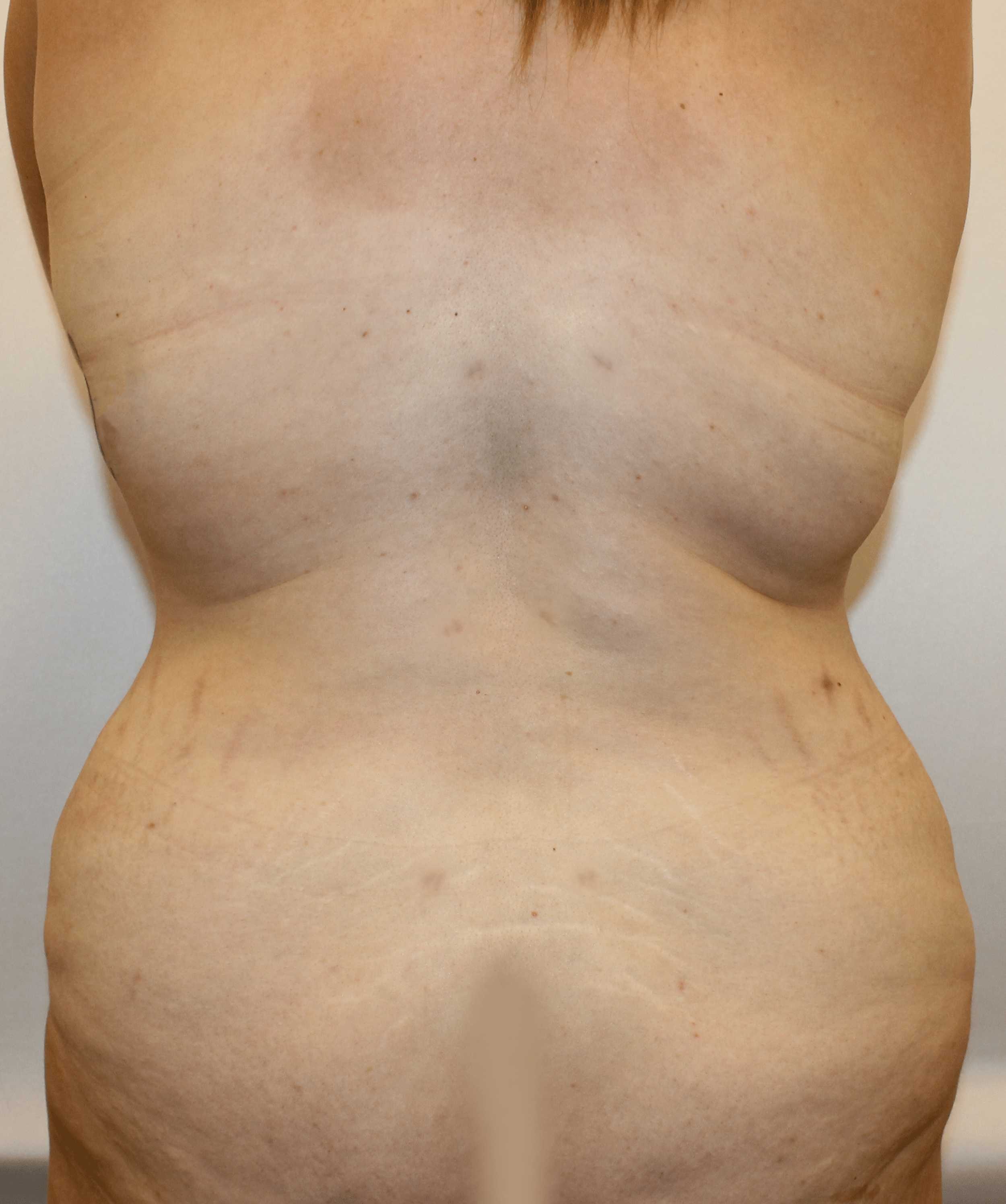 After Image:  - back