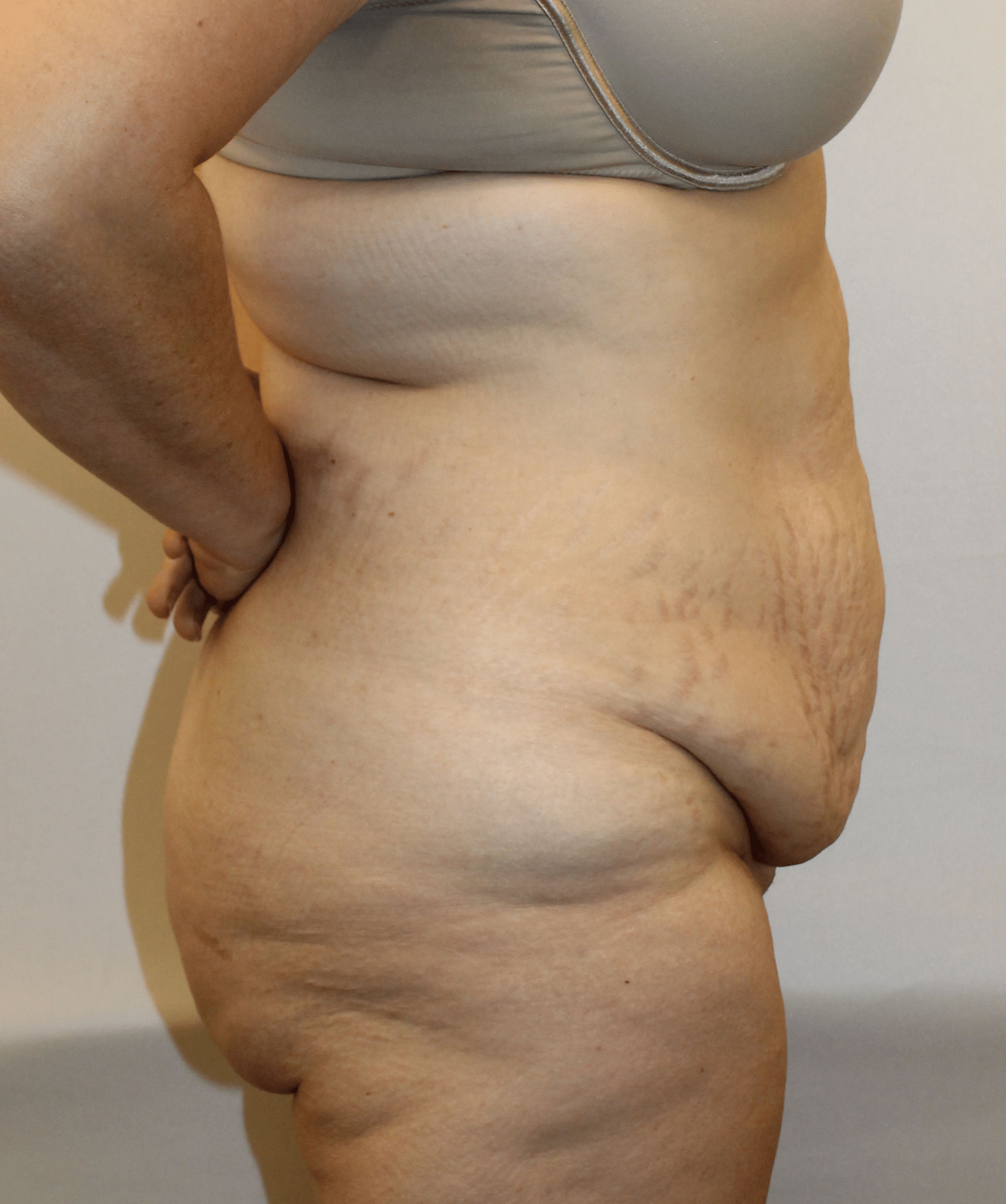 Before Image:  - right-side