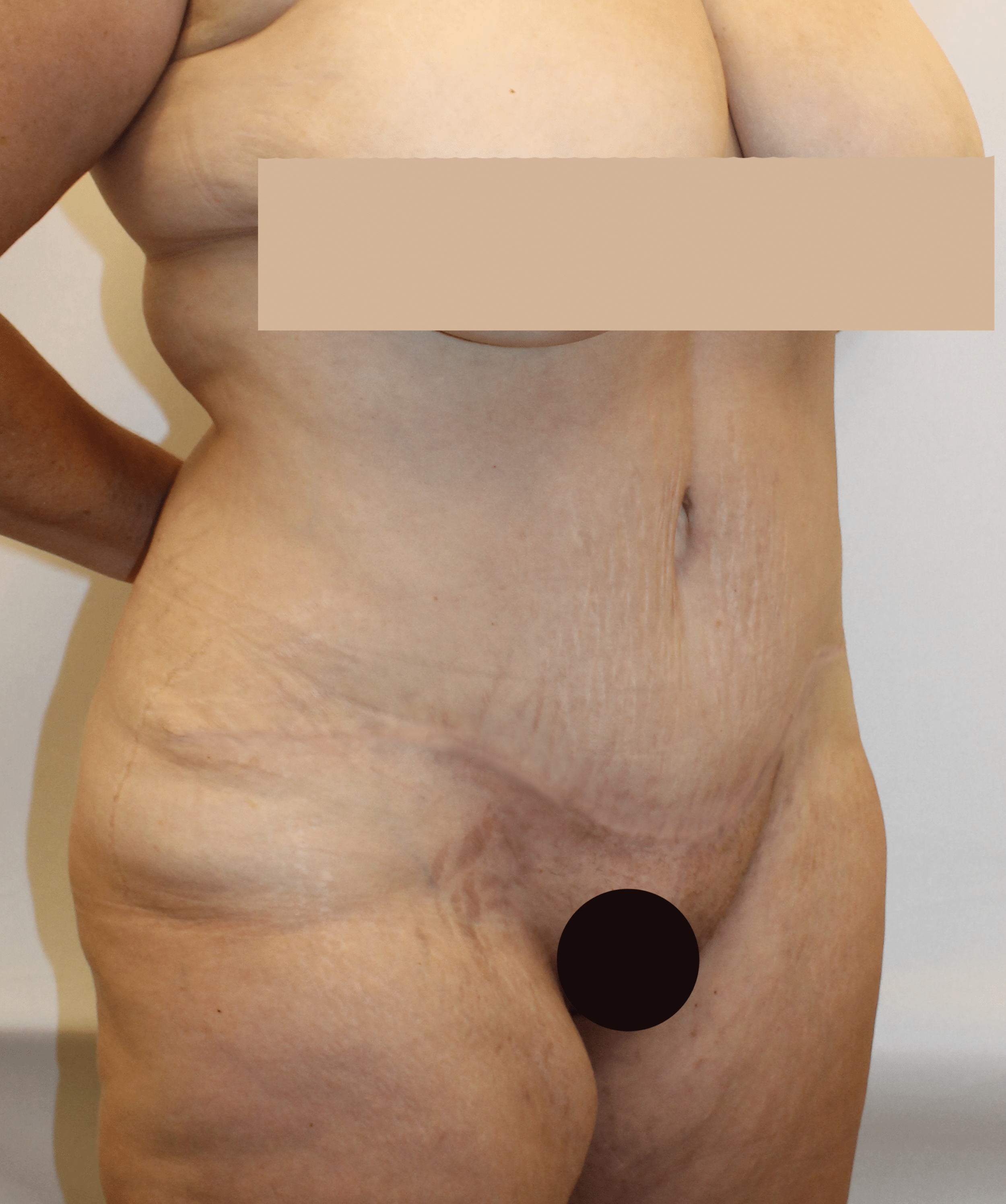 After Image:  - right-front-oblique