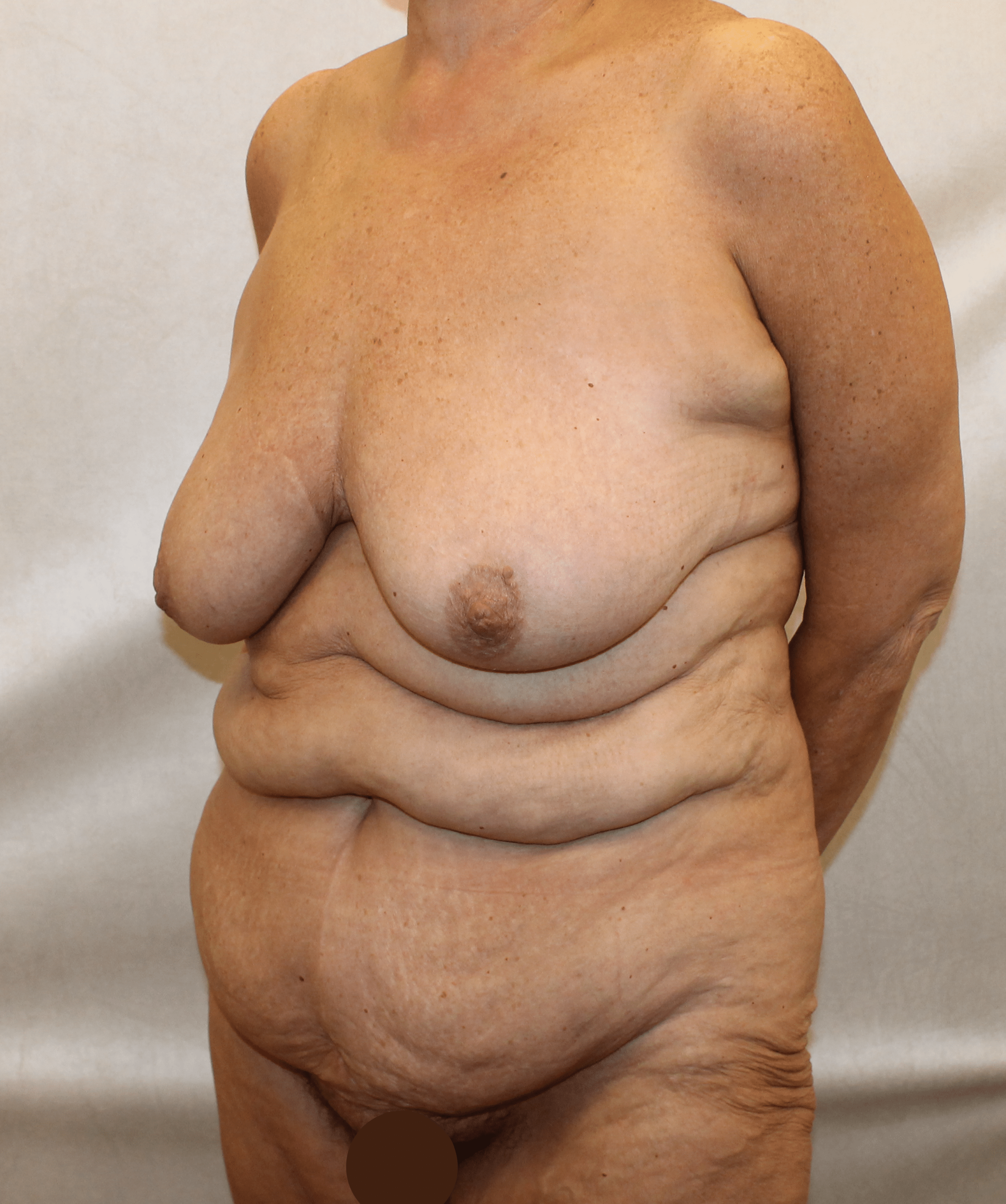Before Image:  - left-front-oblique