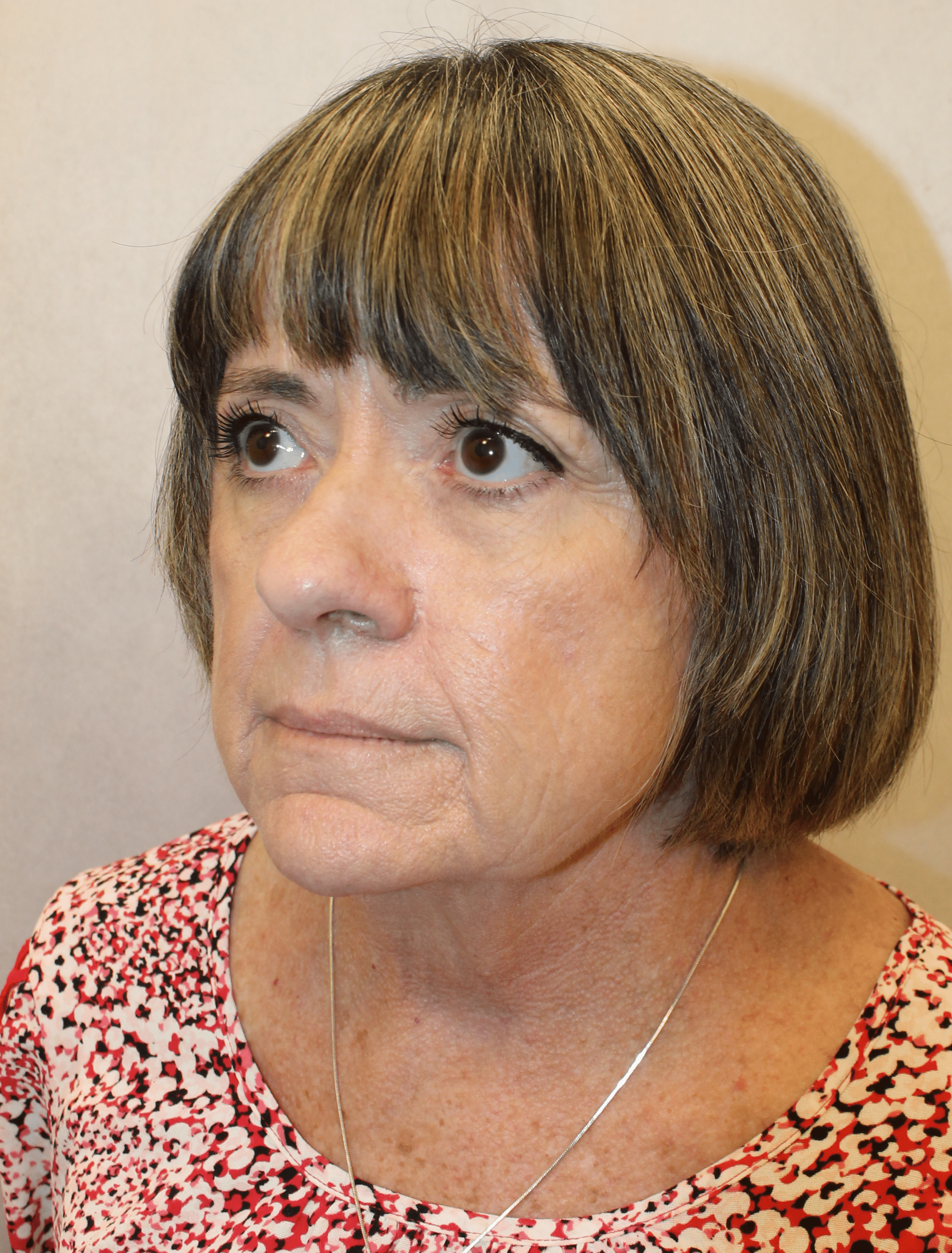 Before Image:  - left-front-oblique
