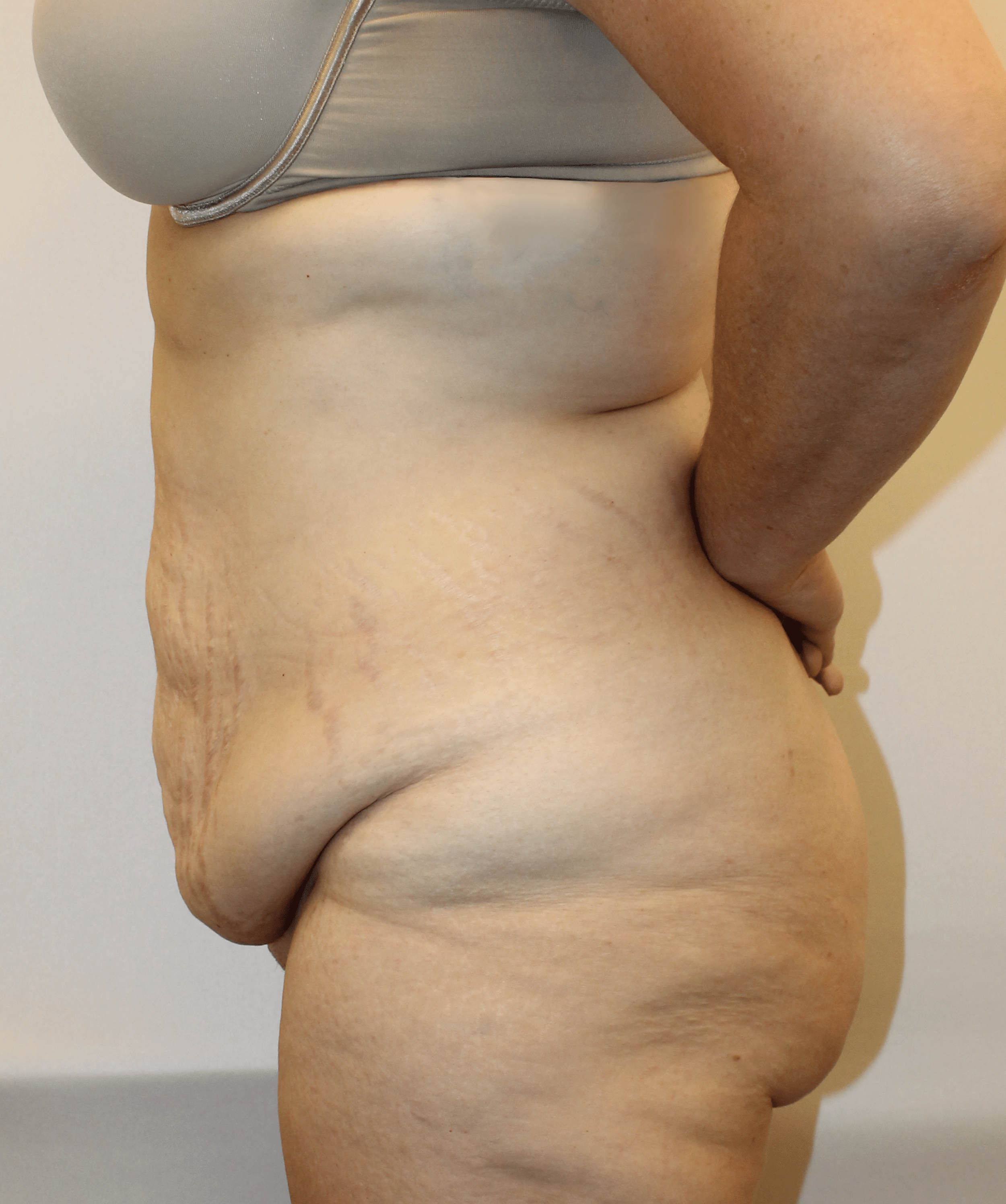 Before Image:  - left-side