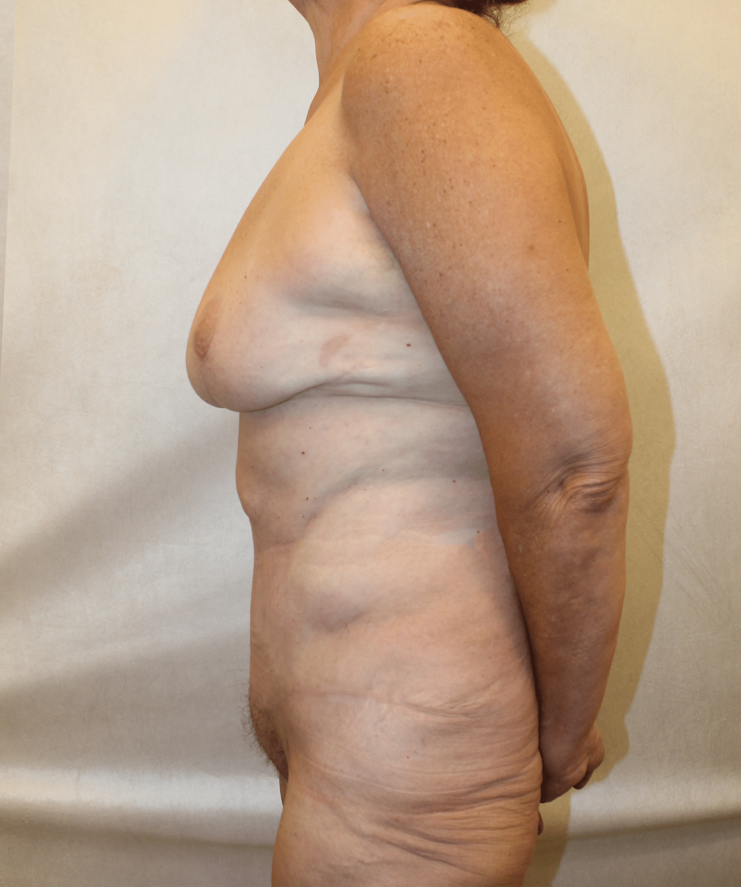 After Image:  - left-side