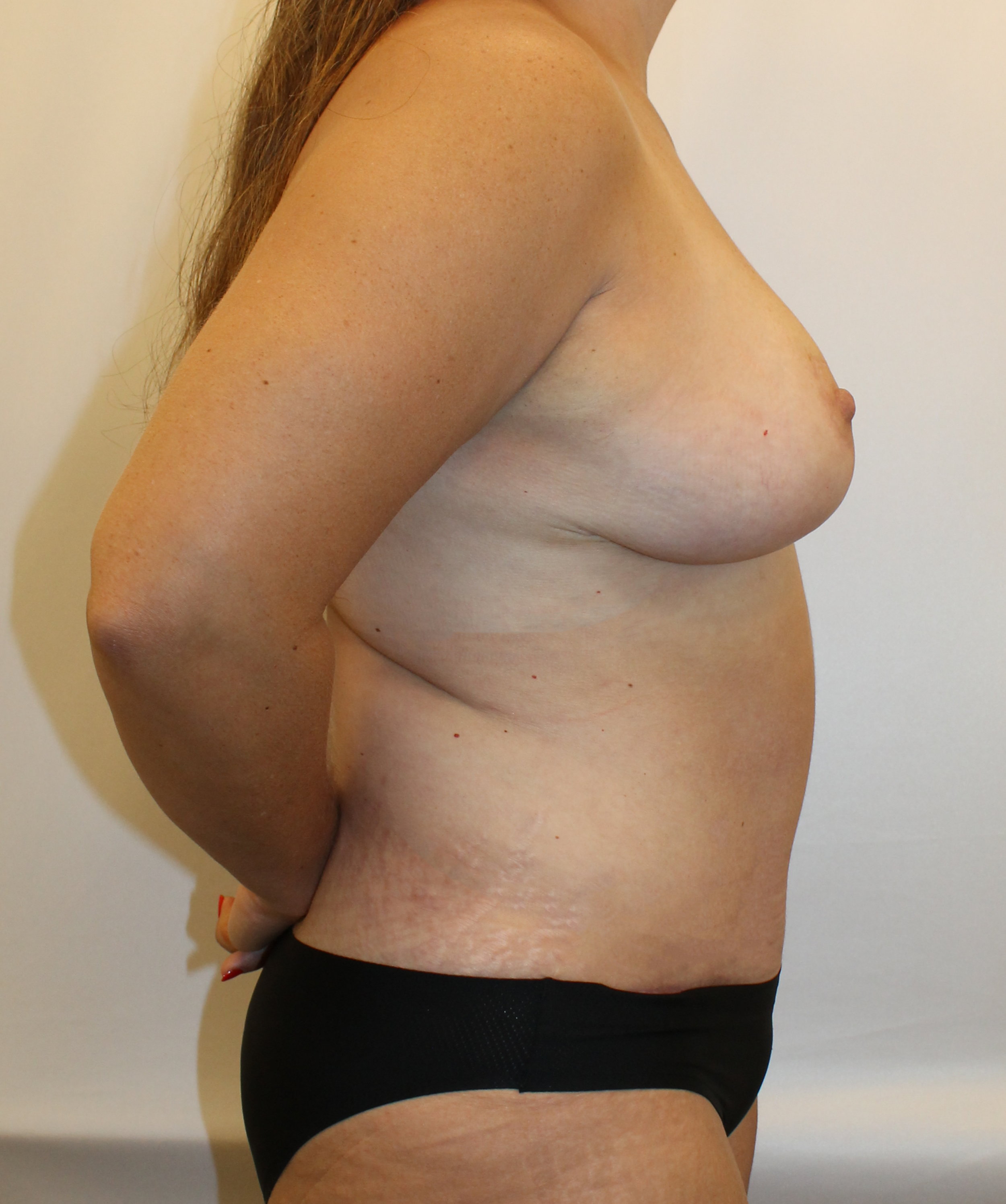 After Image:  - right-side