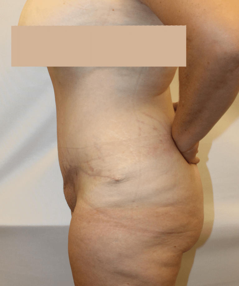 After Image