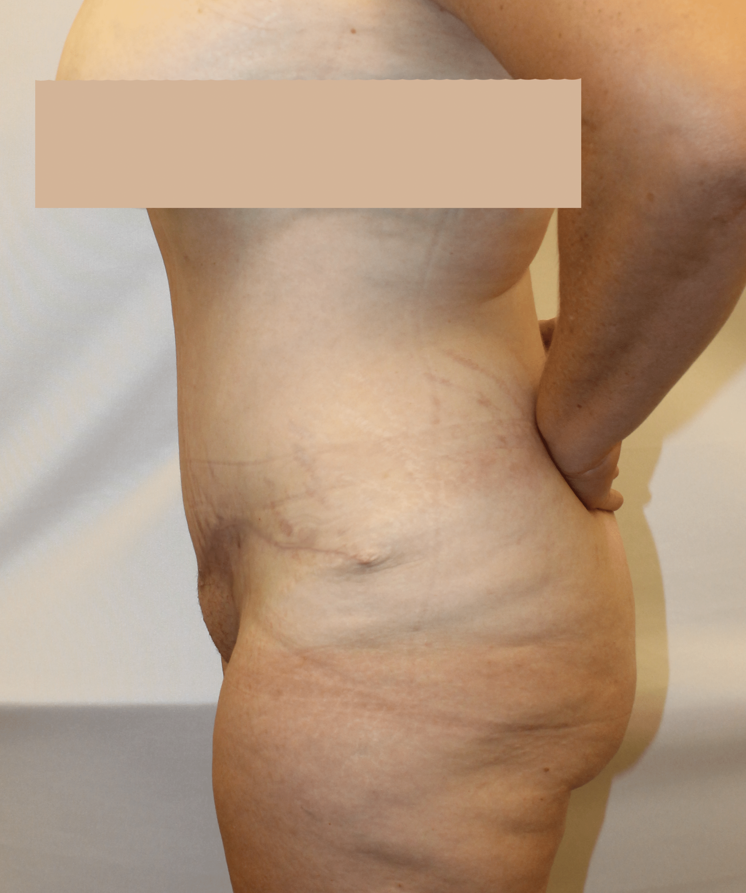 After Image:  - left-side