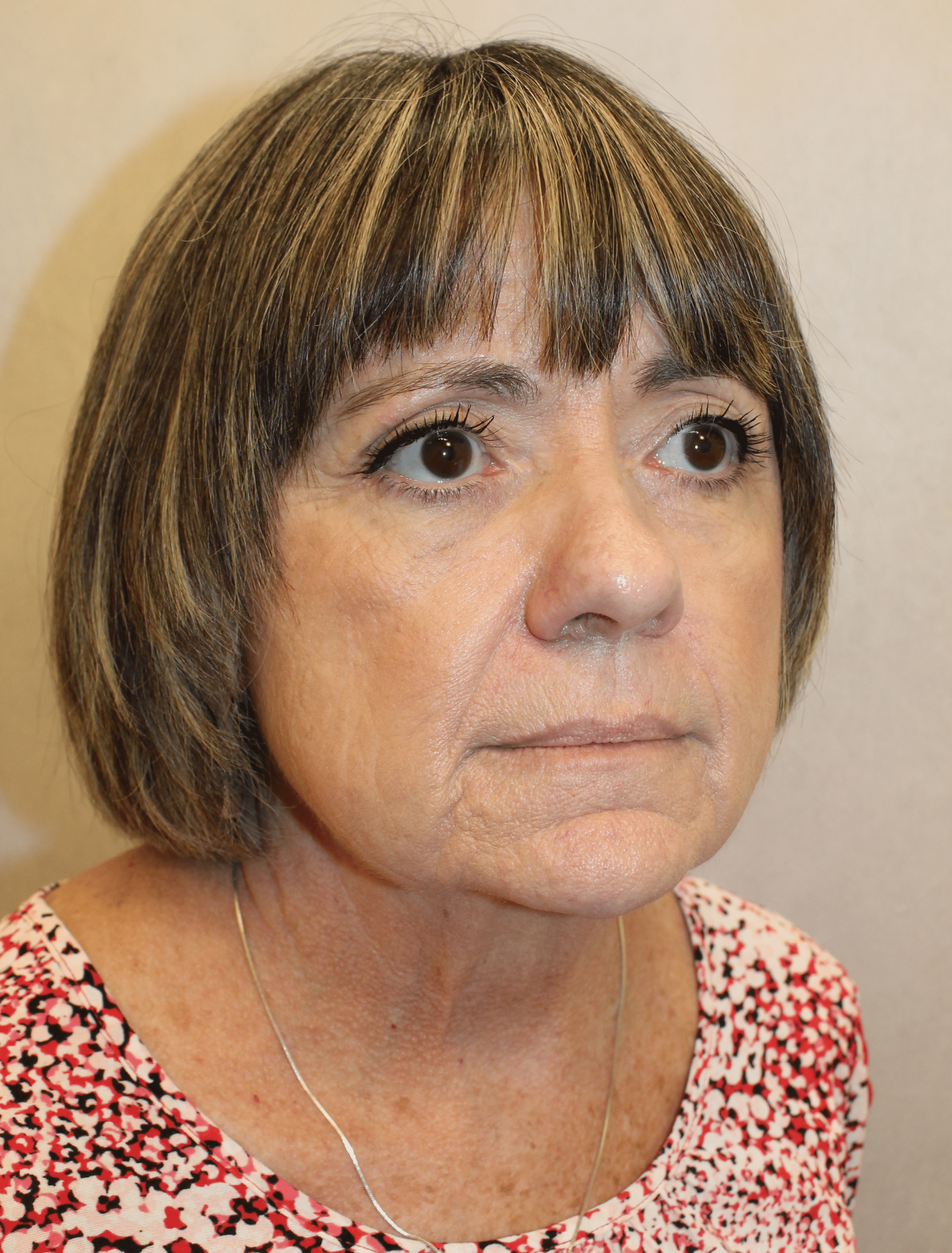 Before Image:  - right-front-oblique