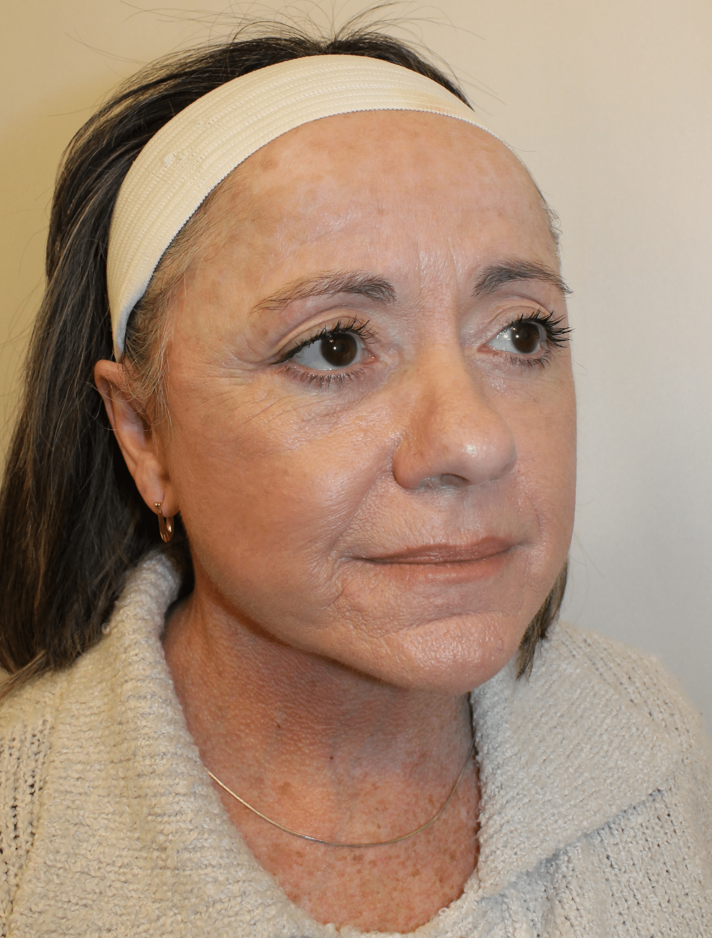 After Image:  - right-front-oblique