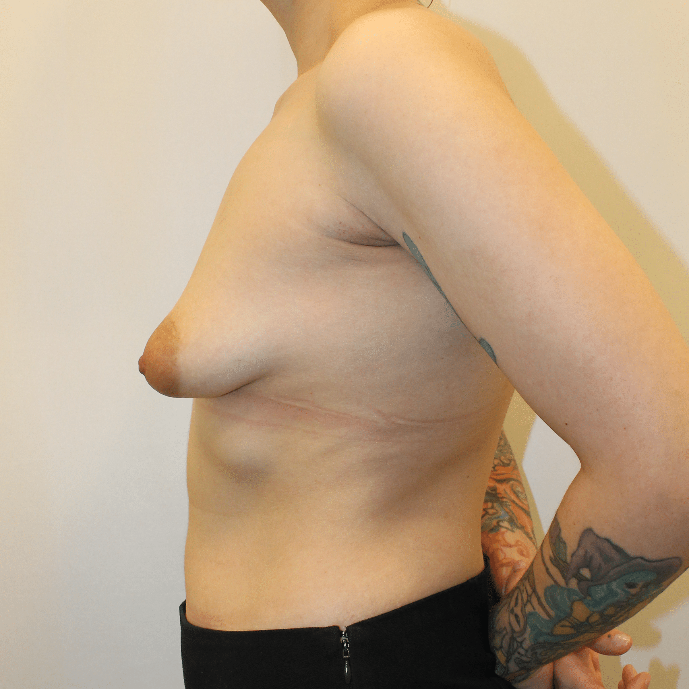 Before Image:  - left-side