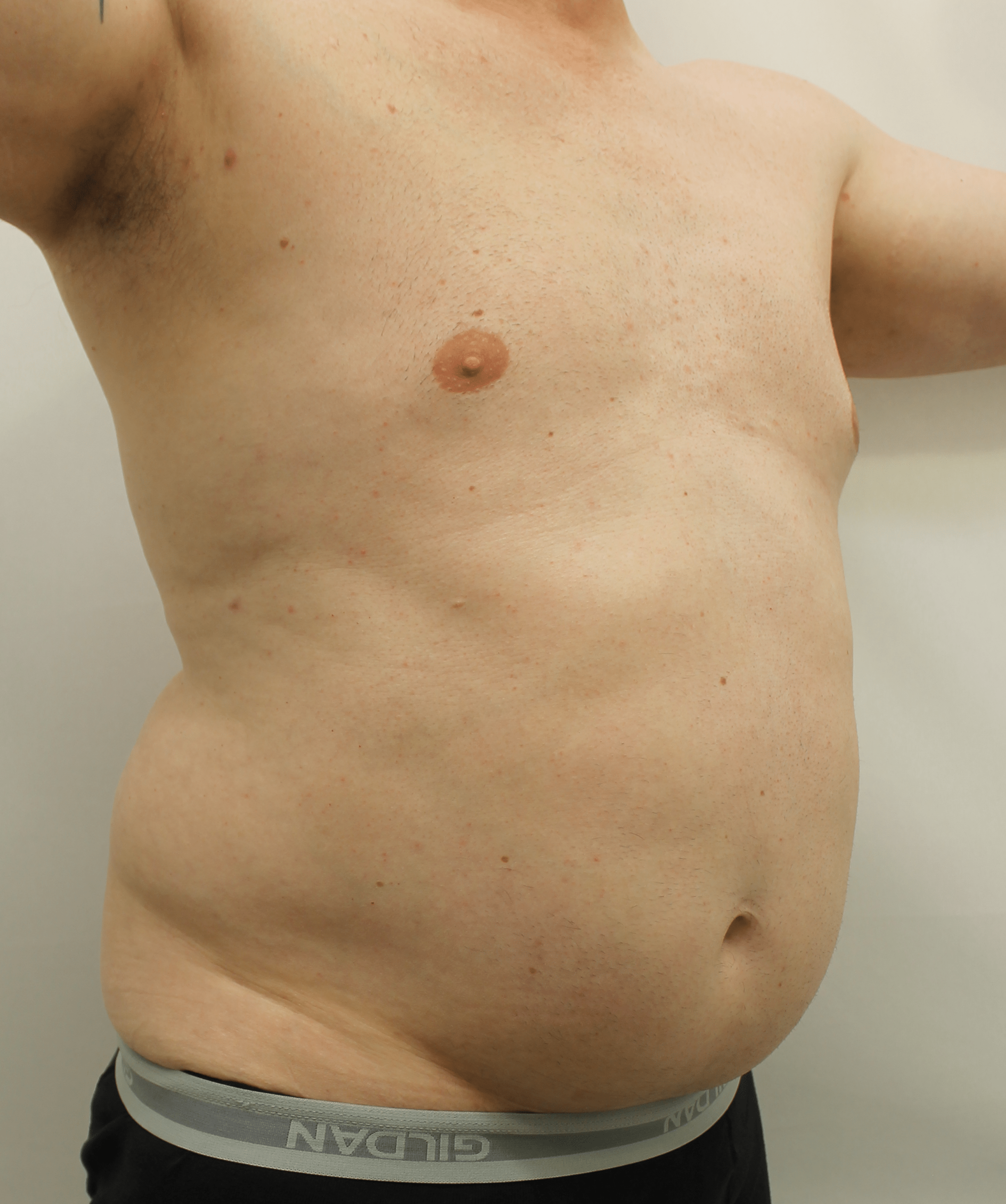 Before Image:  - right-front-oblique