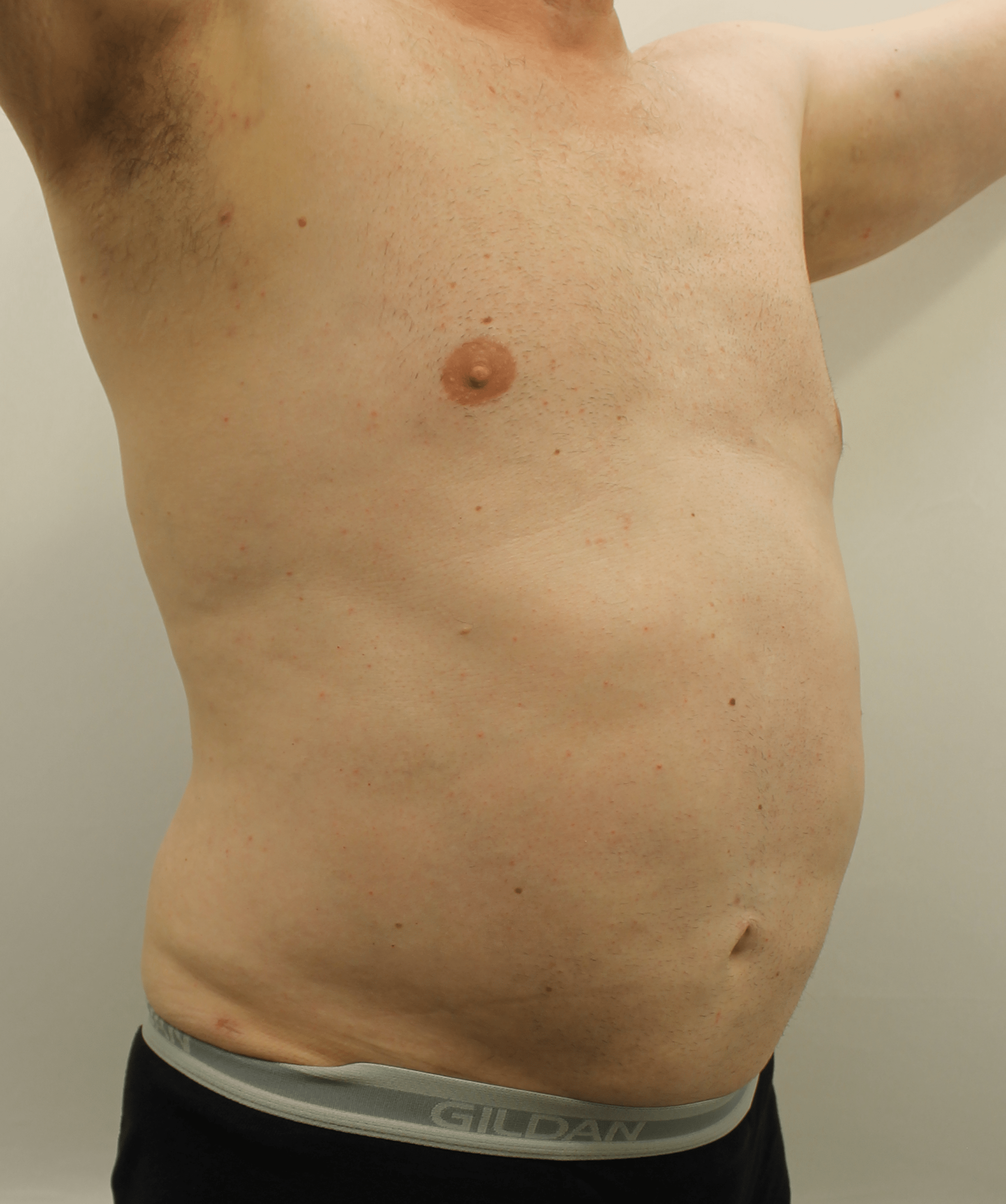 After Image:  - right-front-oblique