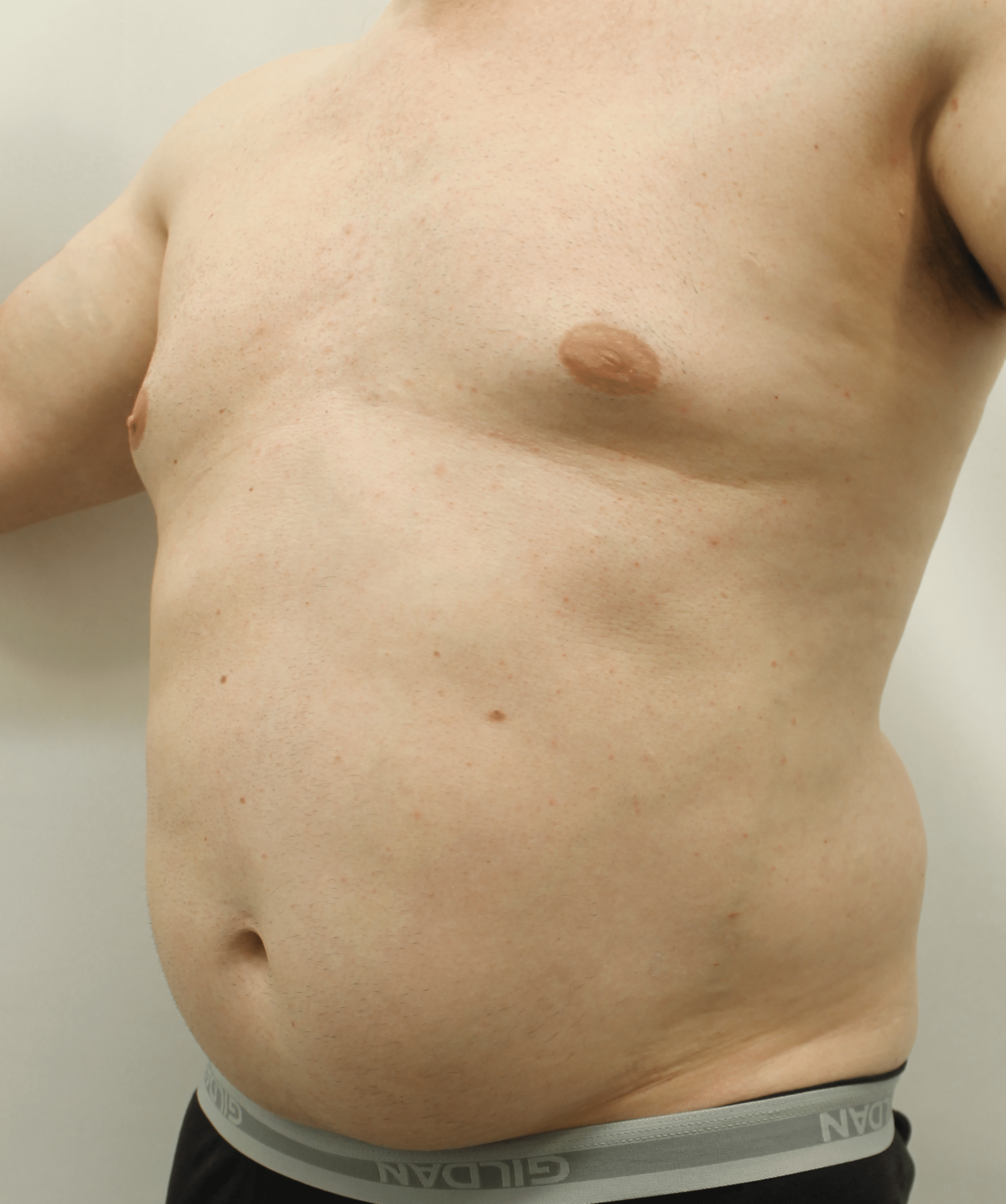 Before Image:  - left-front-oblique