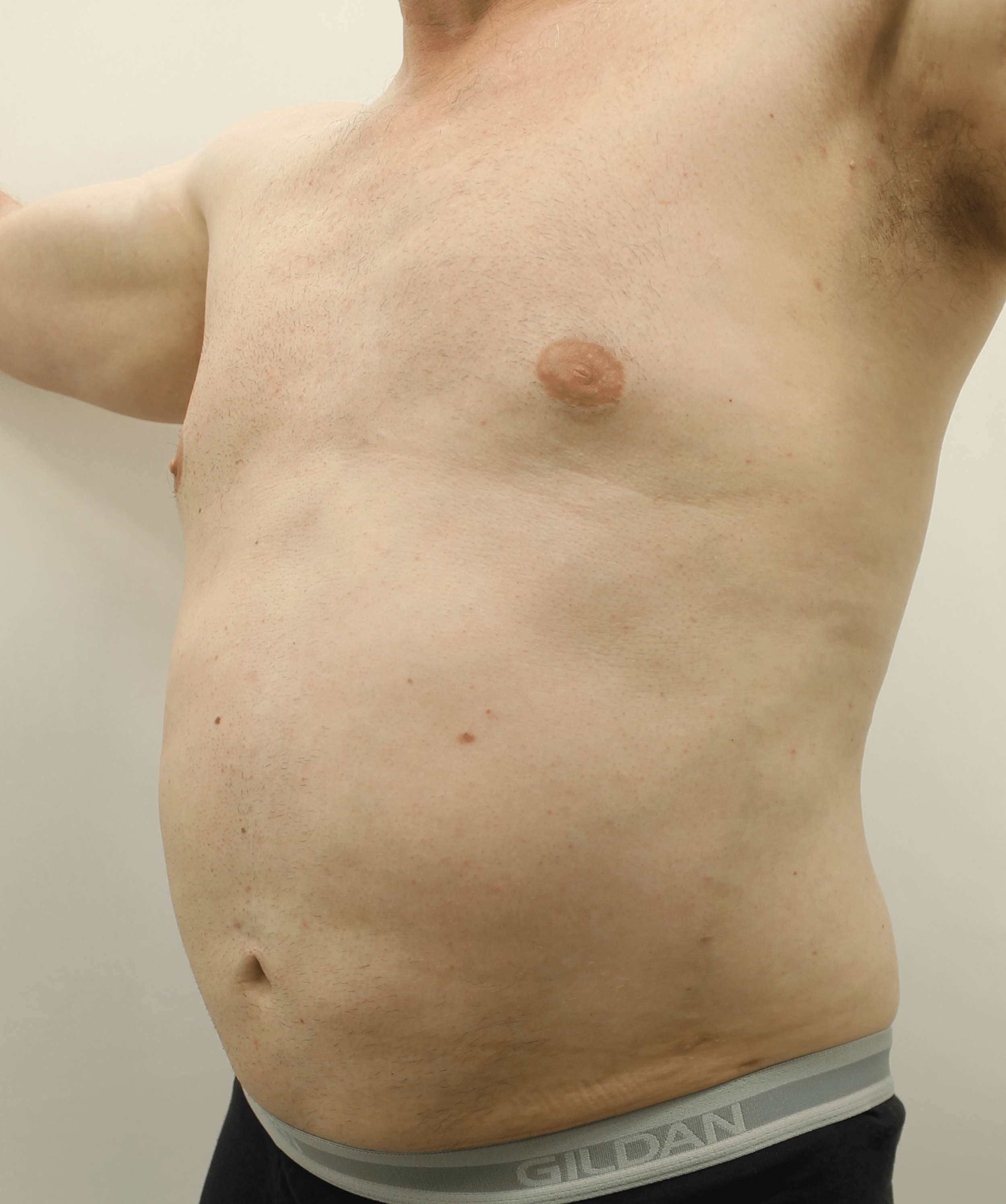 After Image:  - left-front-oblique