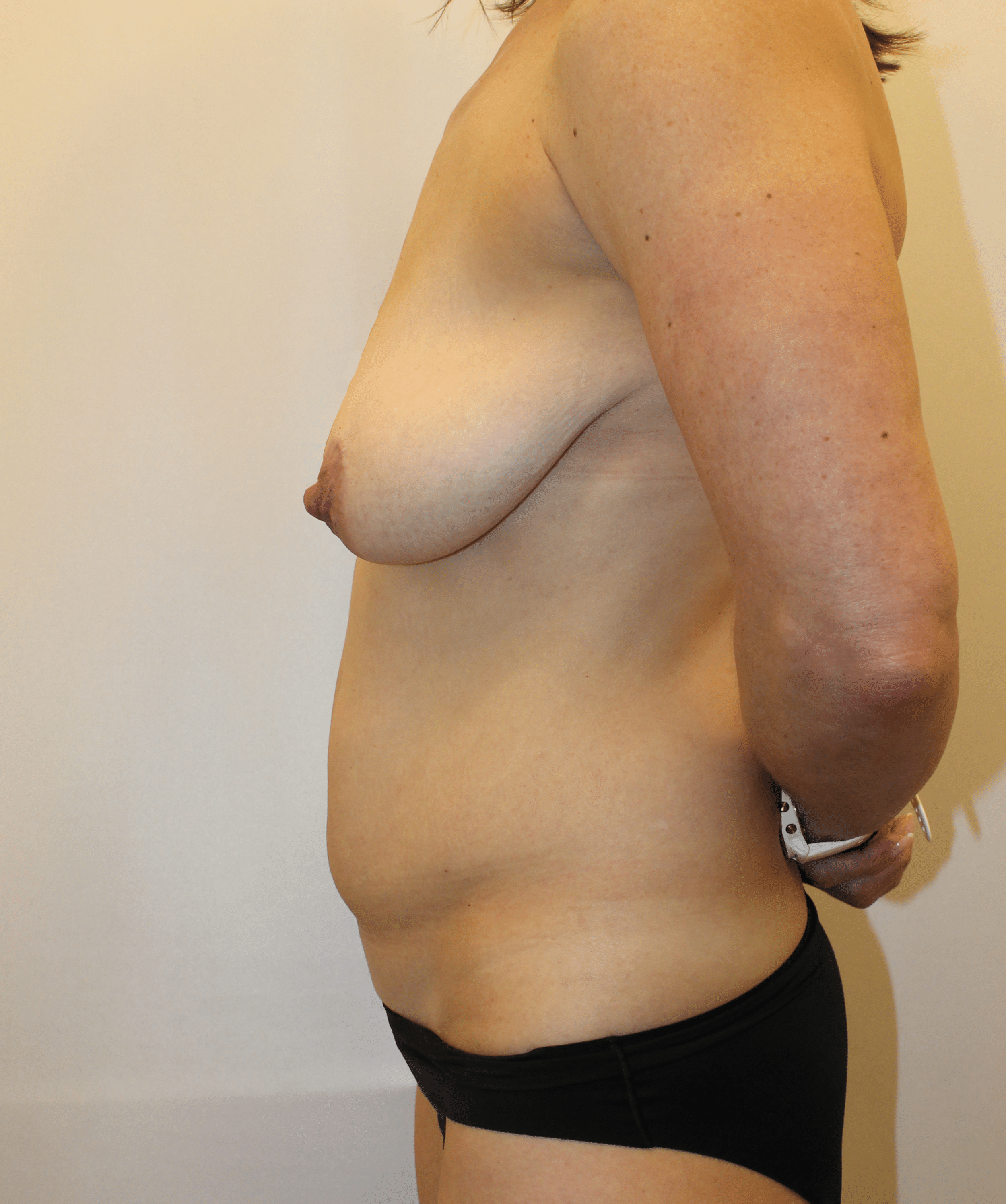 Before Image:  - left-side