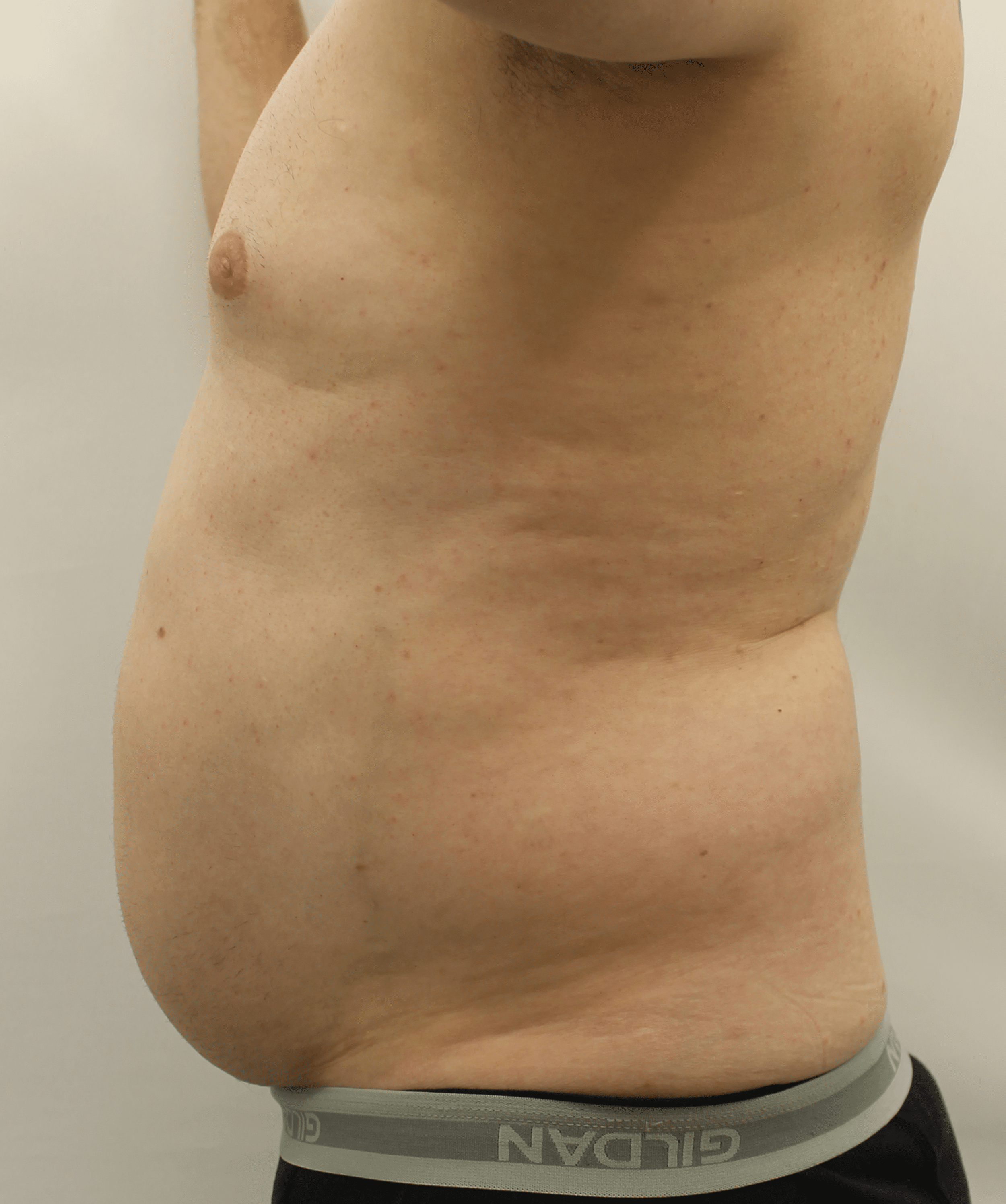 Before Image:  - left-side
