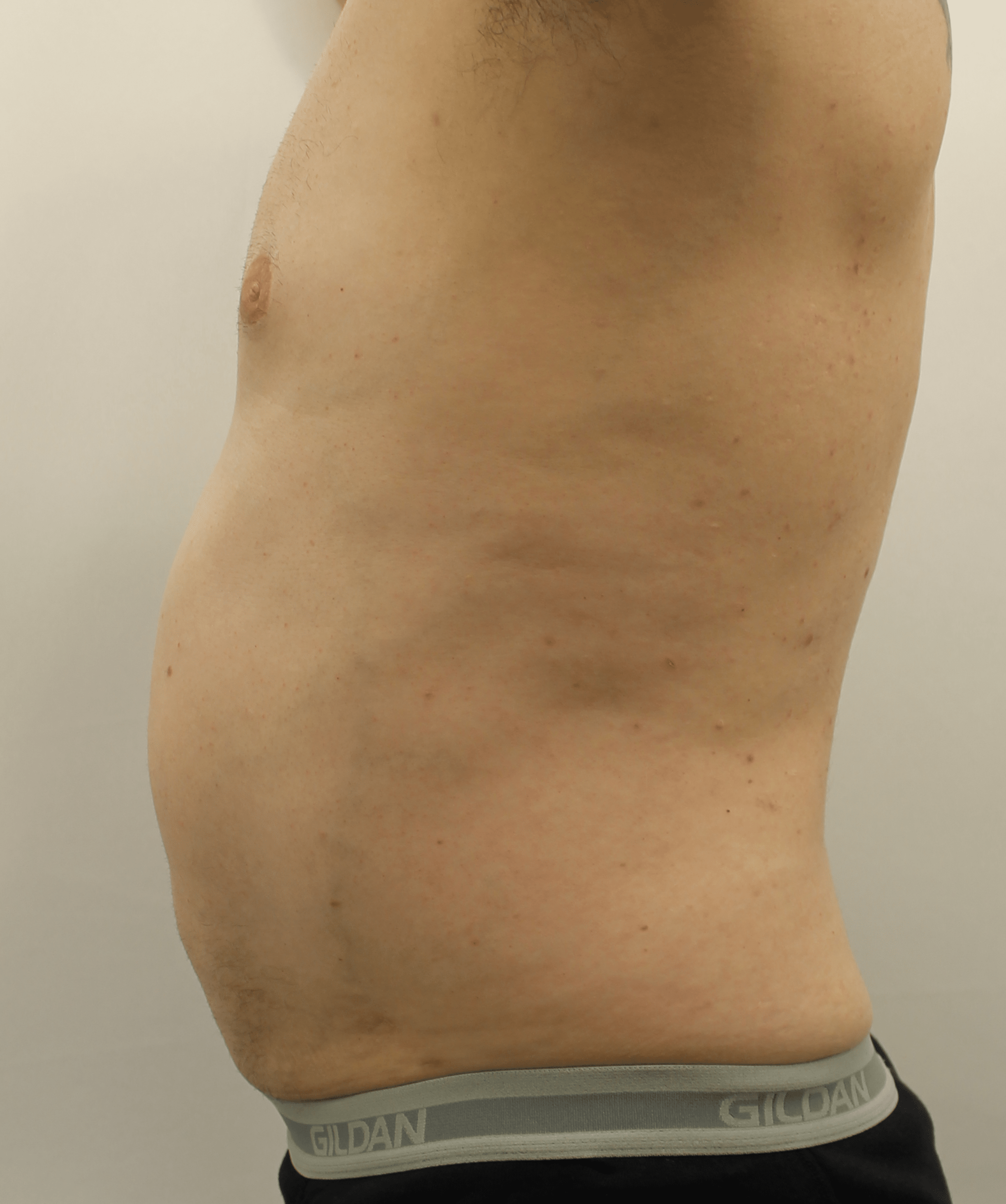 After Image:  - left-side