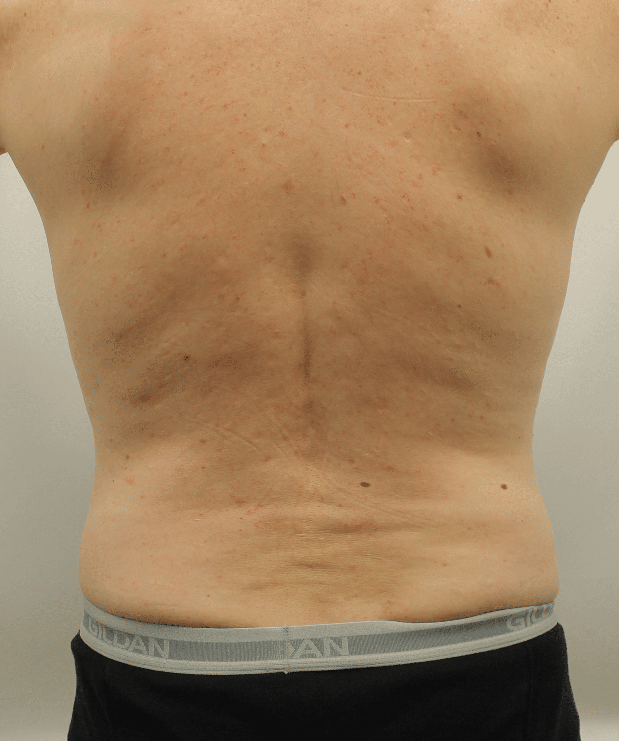 After Image:  - back