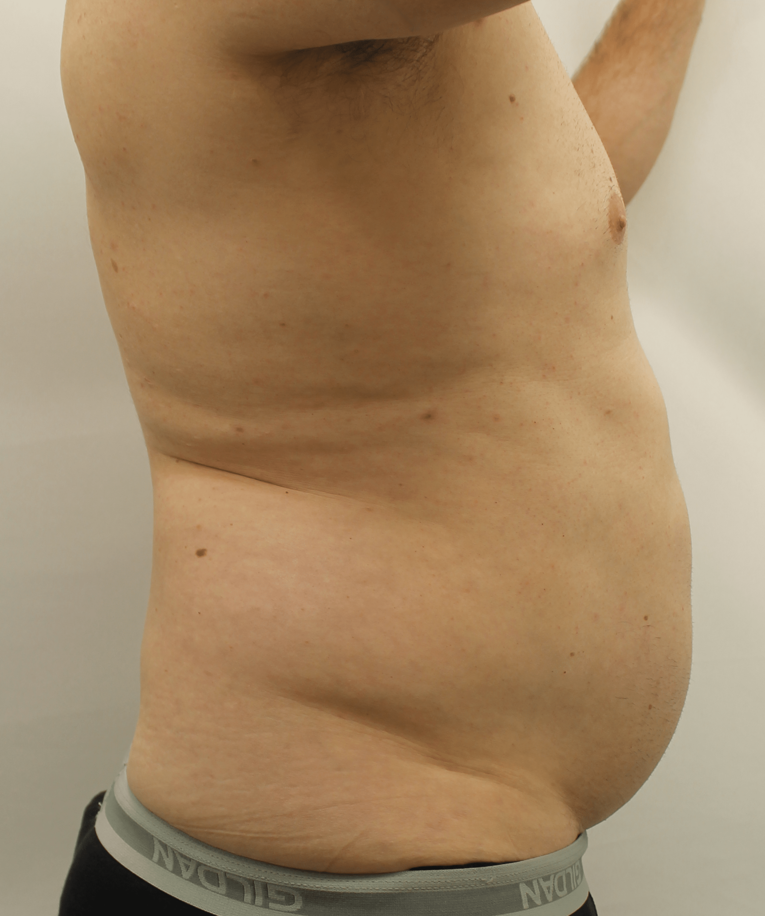 Before Image:  - right-side