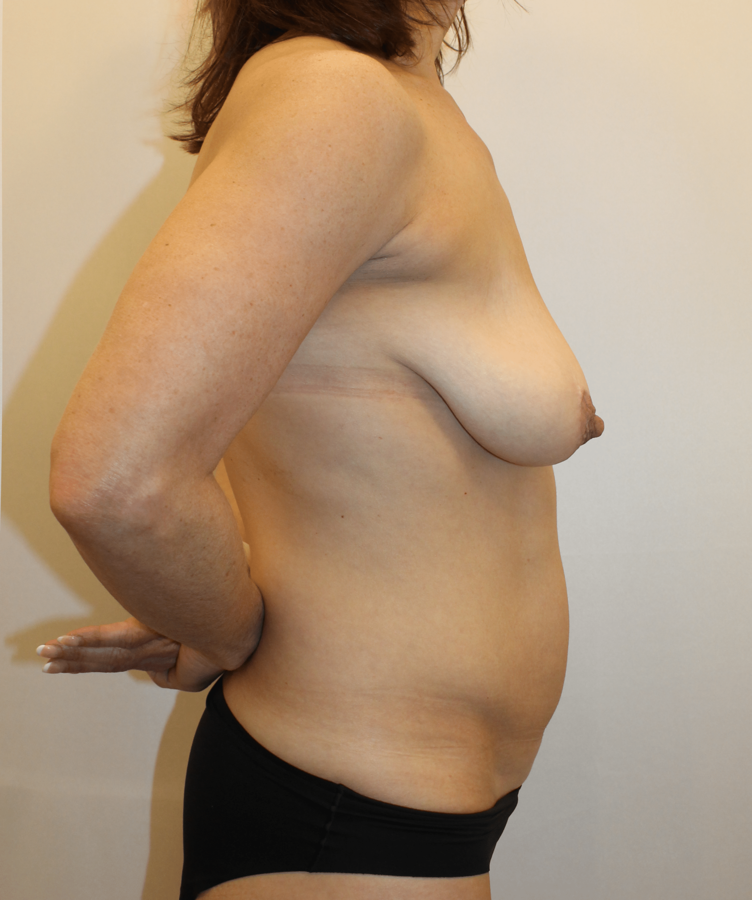 Before Image:  - right-side