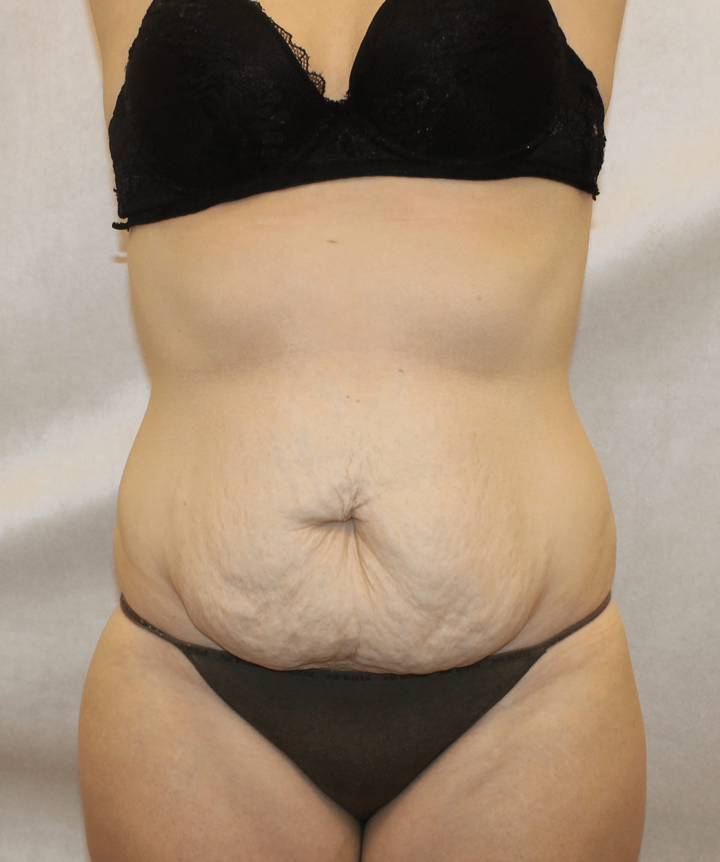 Before Image:  - front
