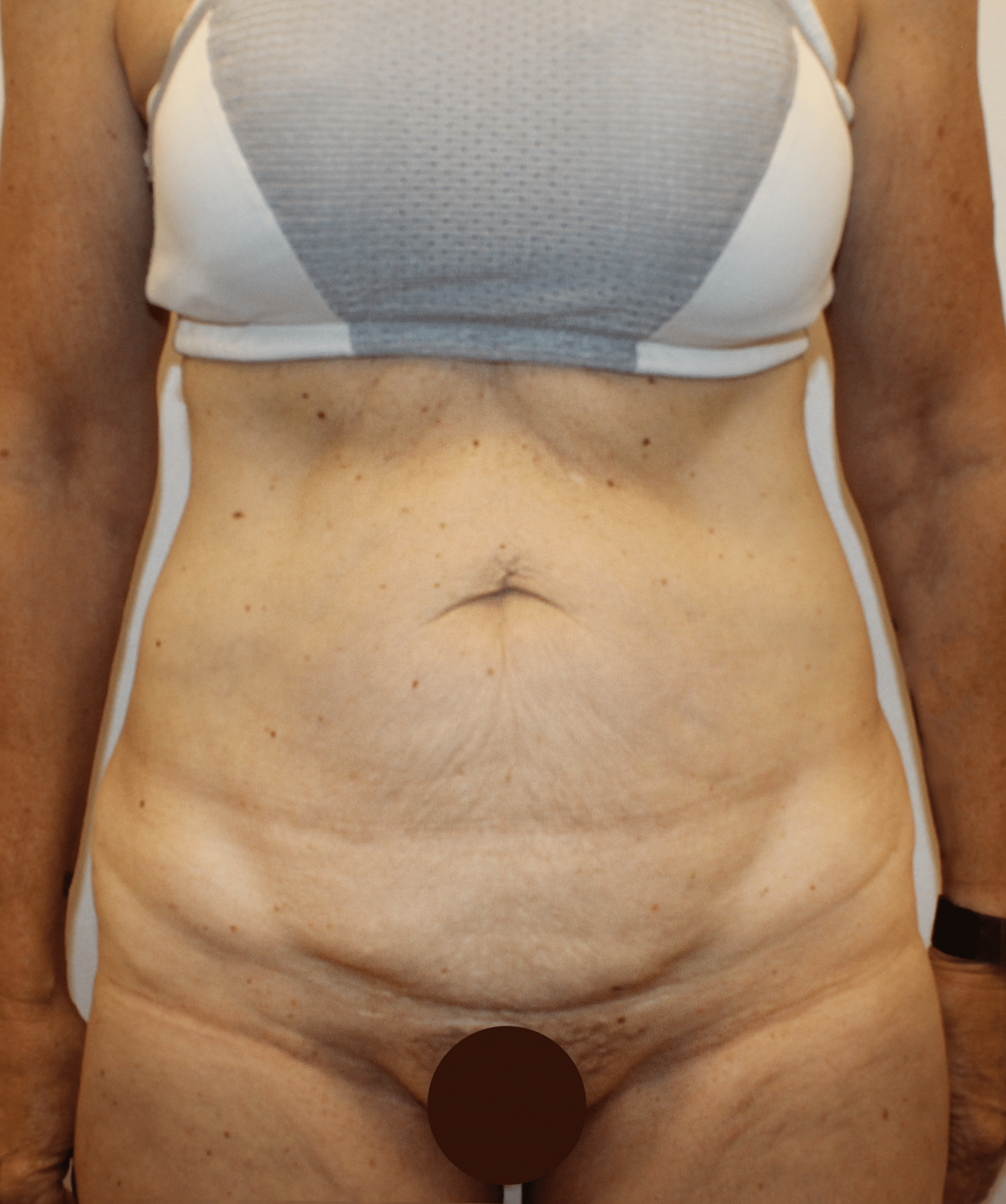 Before Image:  - front