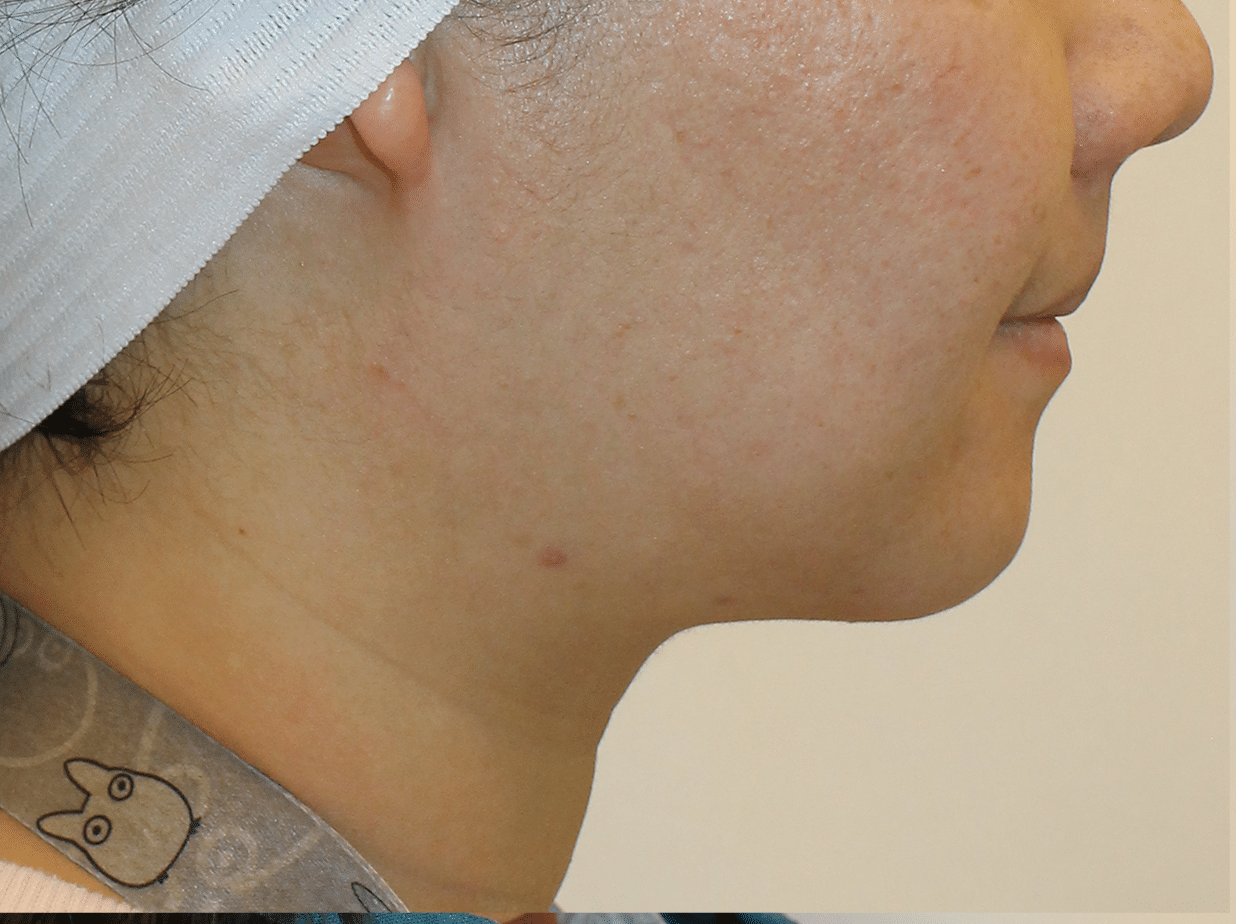 After Image:  - right-side