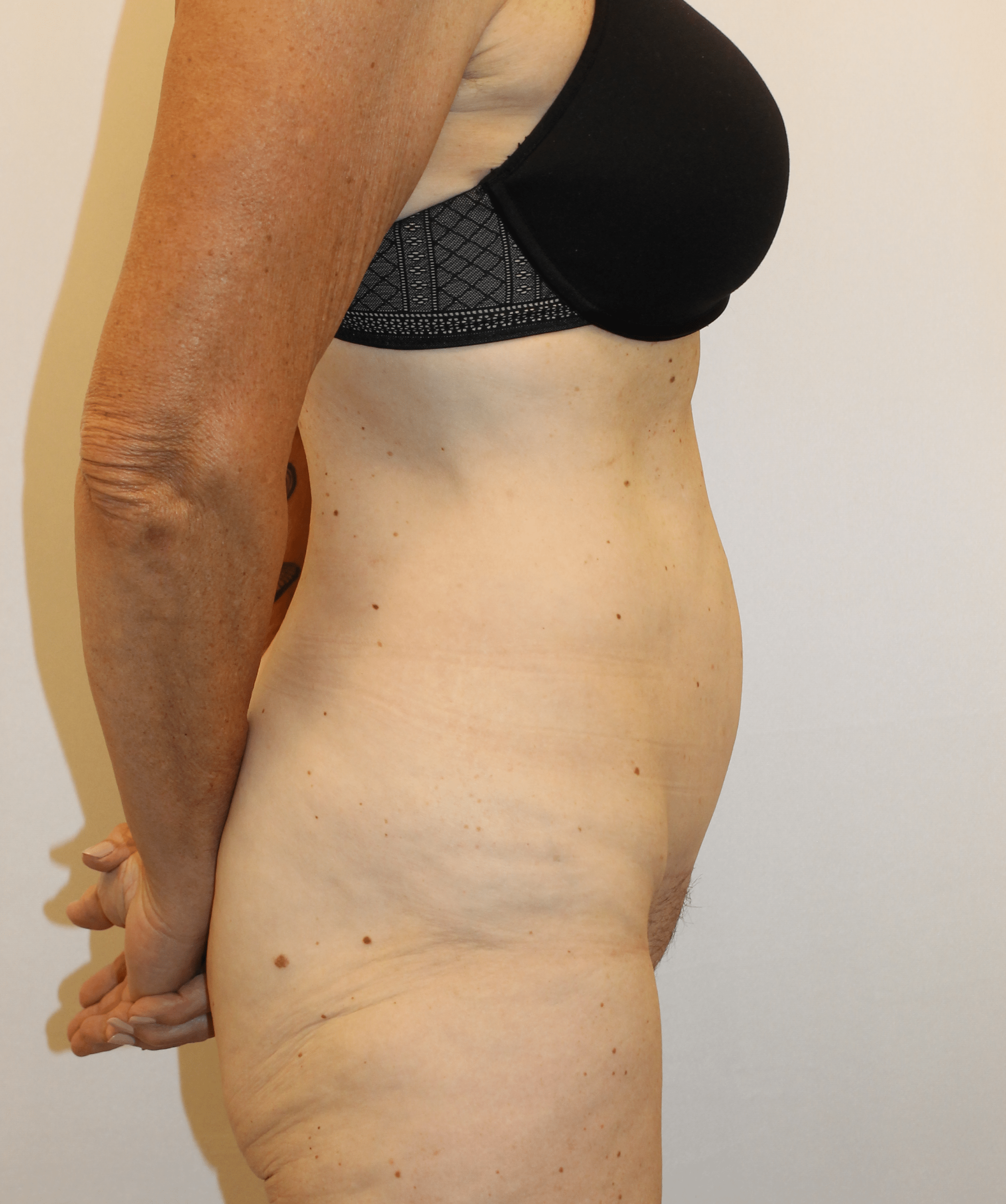 After Image:  - right-side