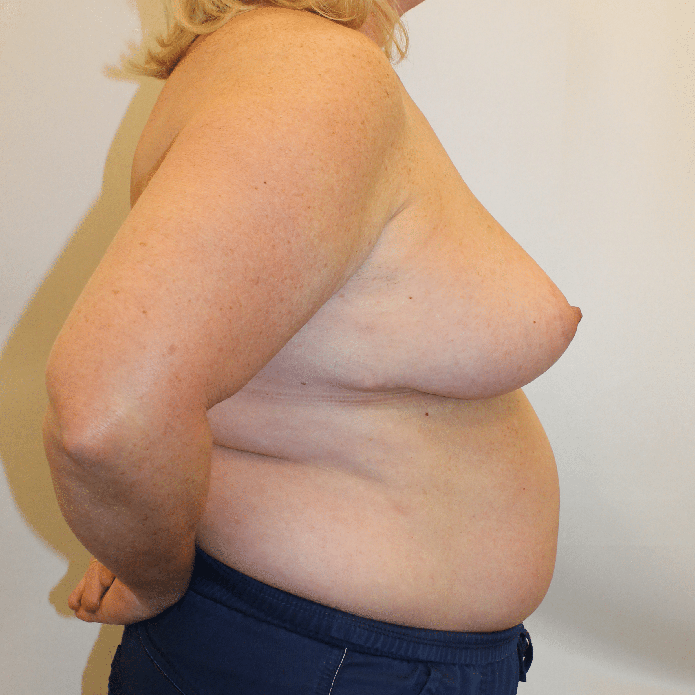 After Image:  - right-side