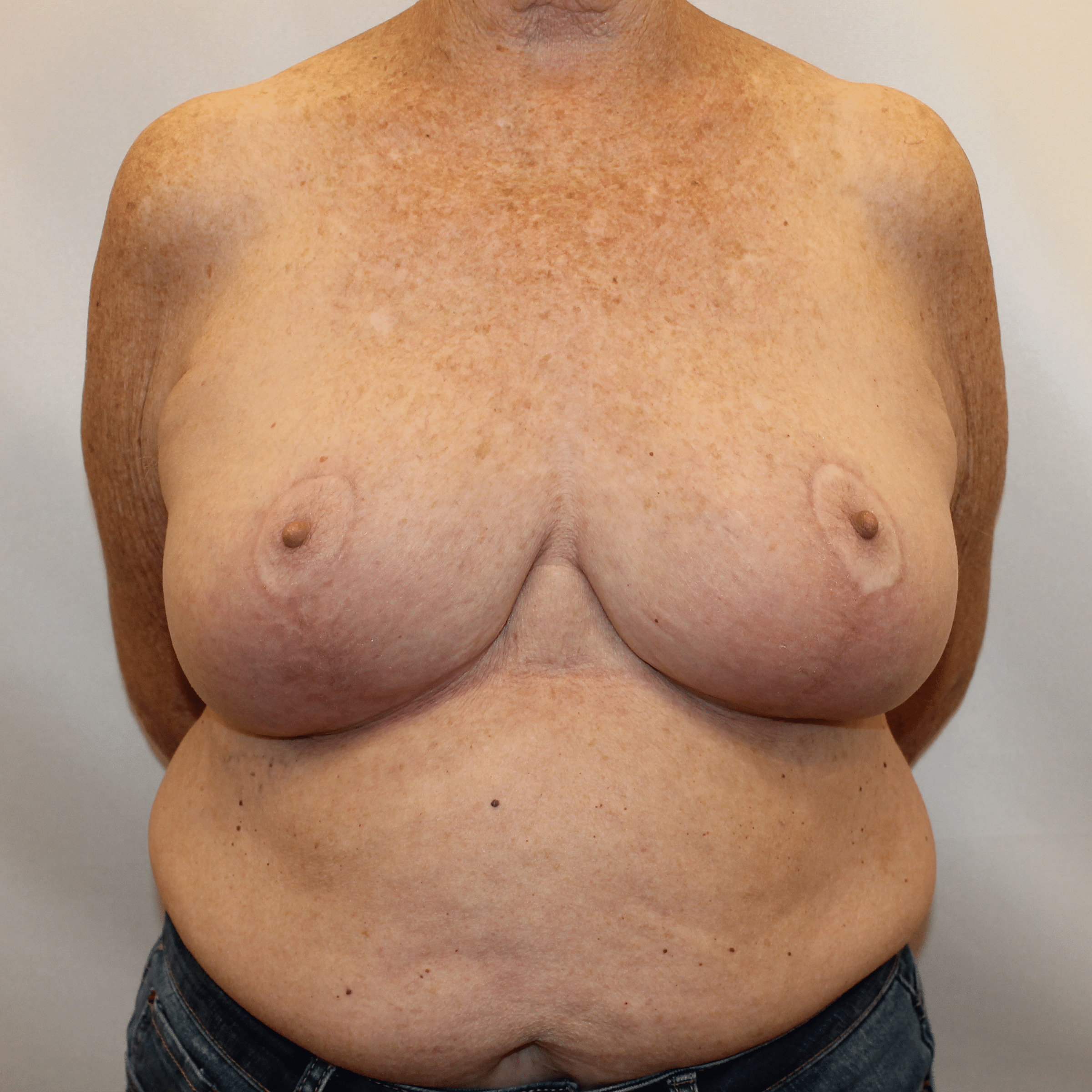 After Image:  - front