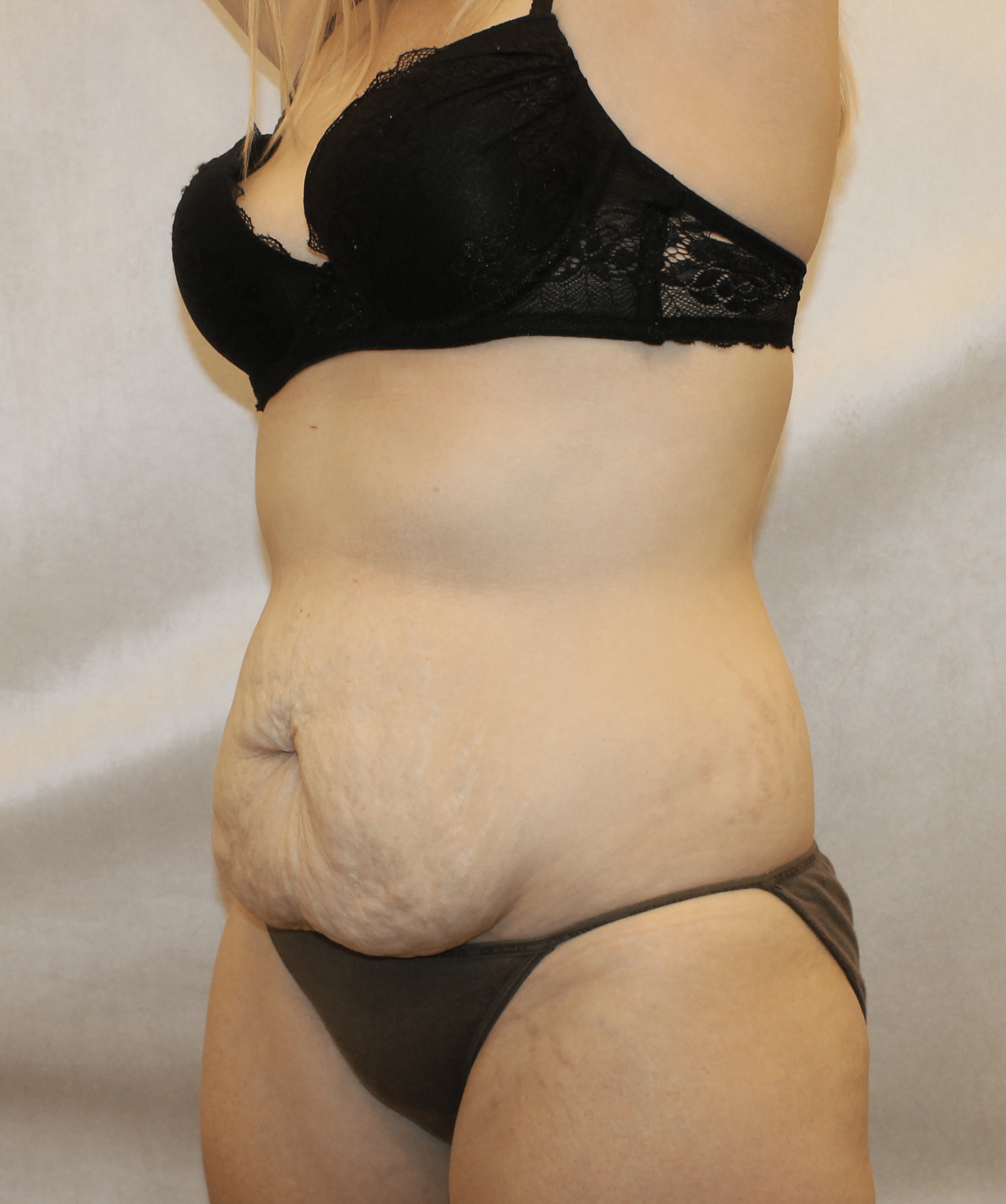 Before Image:  - left-front-oblique