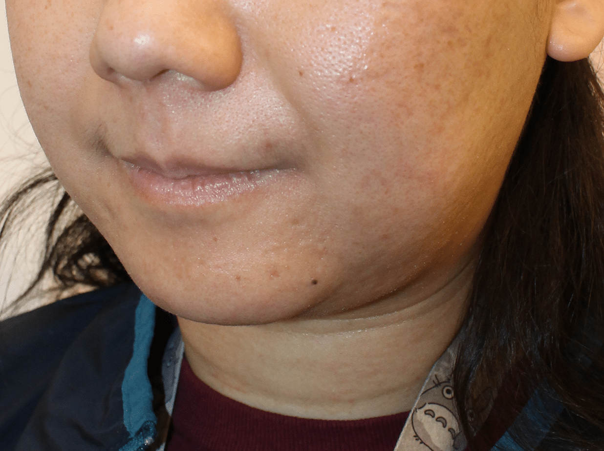 Before Image:  - left-front-oblique