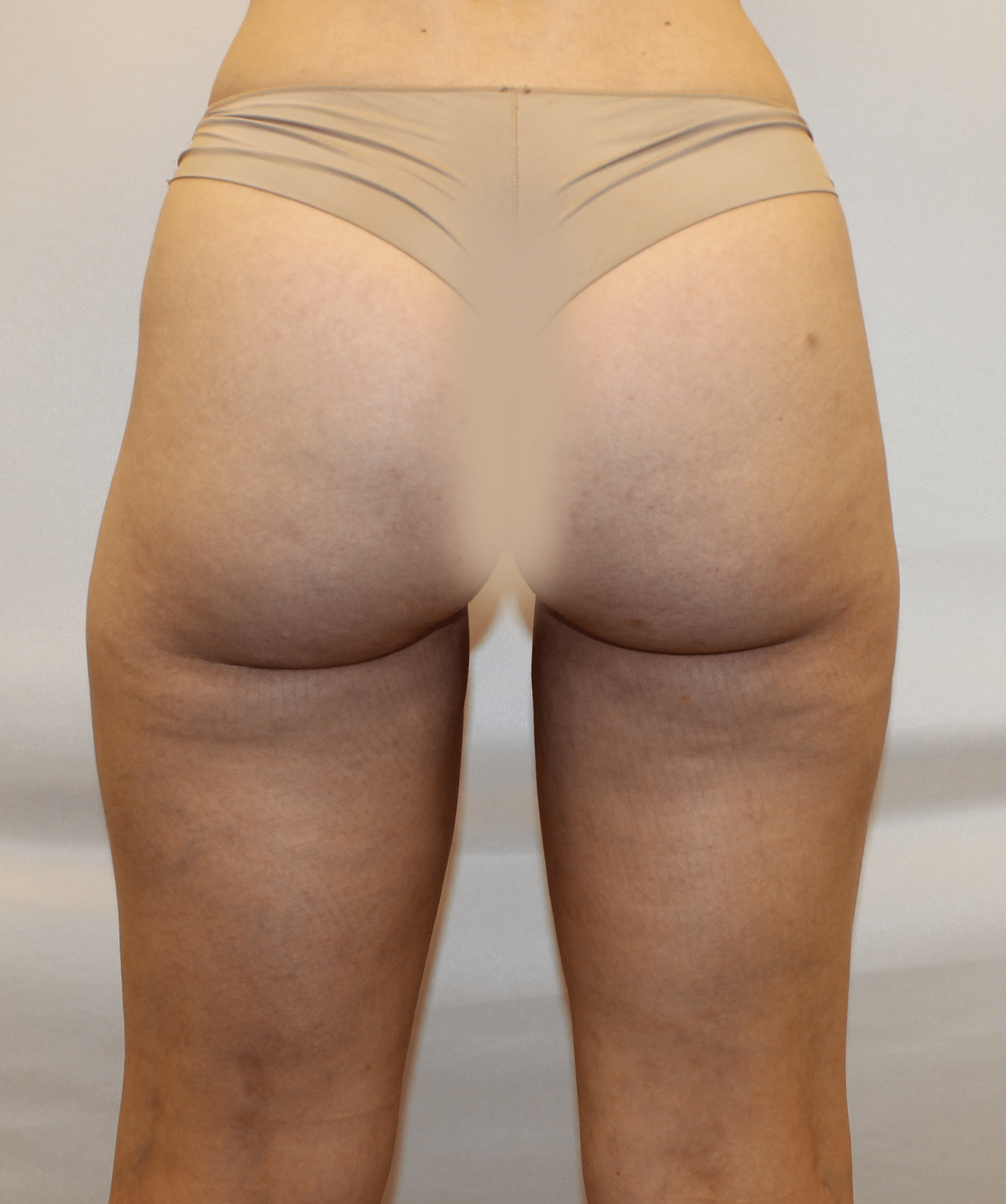 After Image:  - back