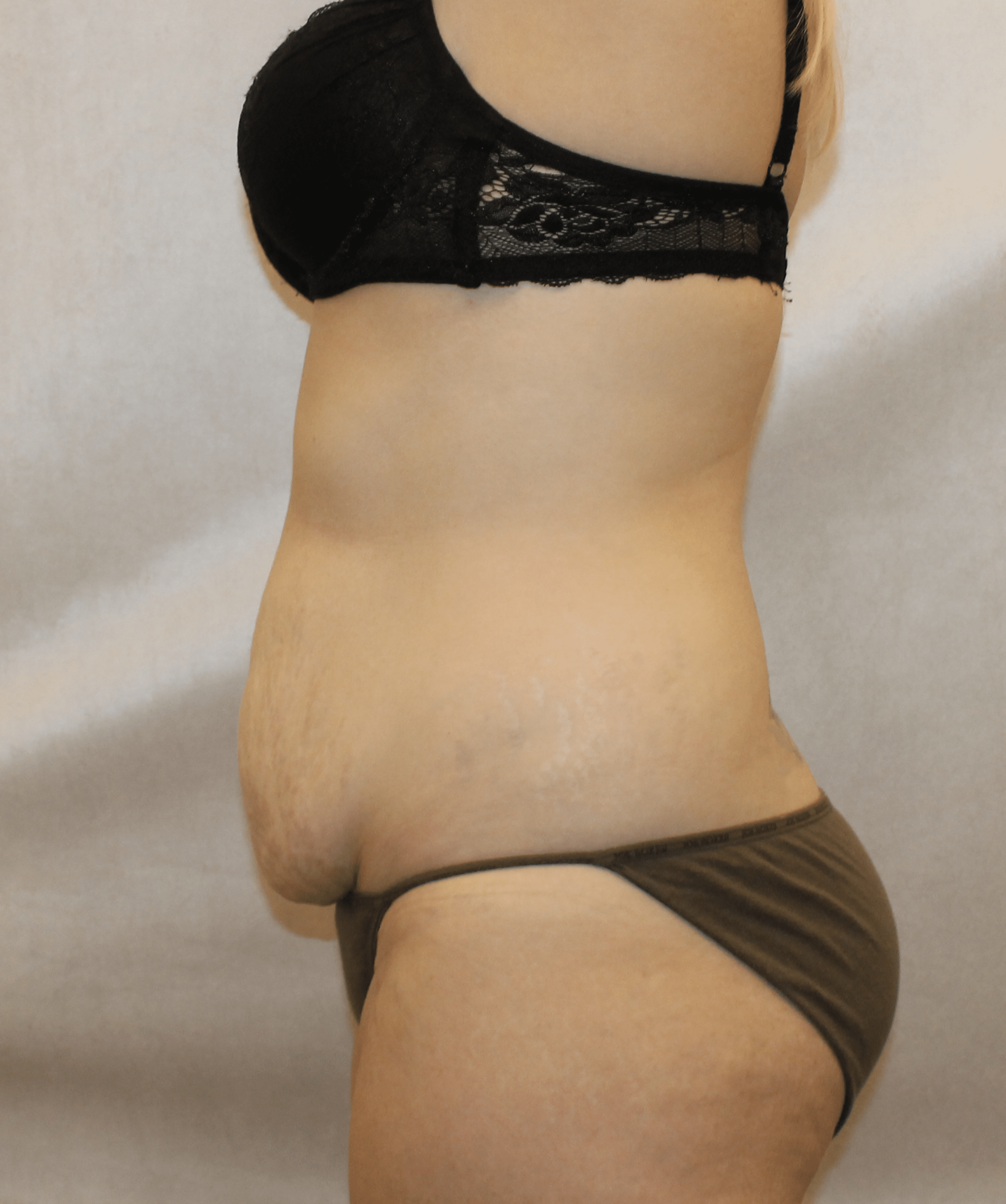 Before Image:  - left-side
