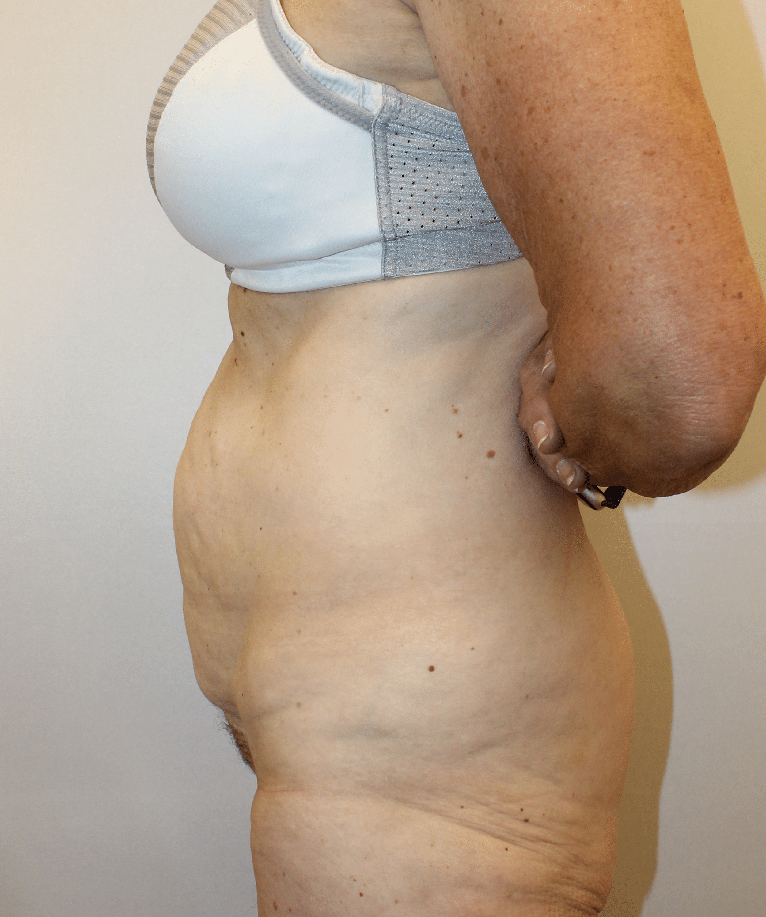 Before Image:  - left-side