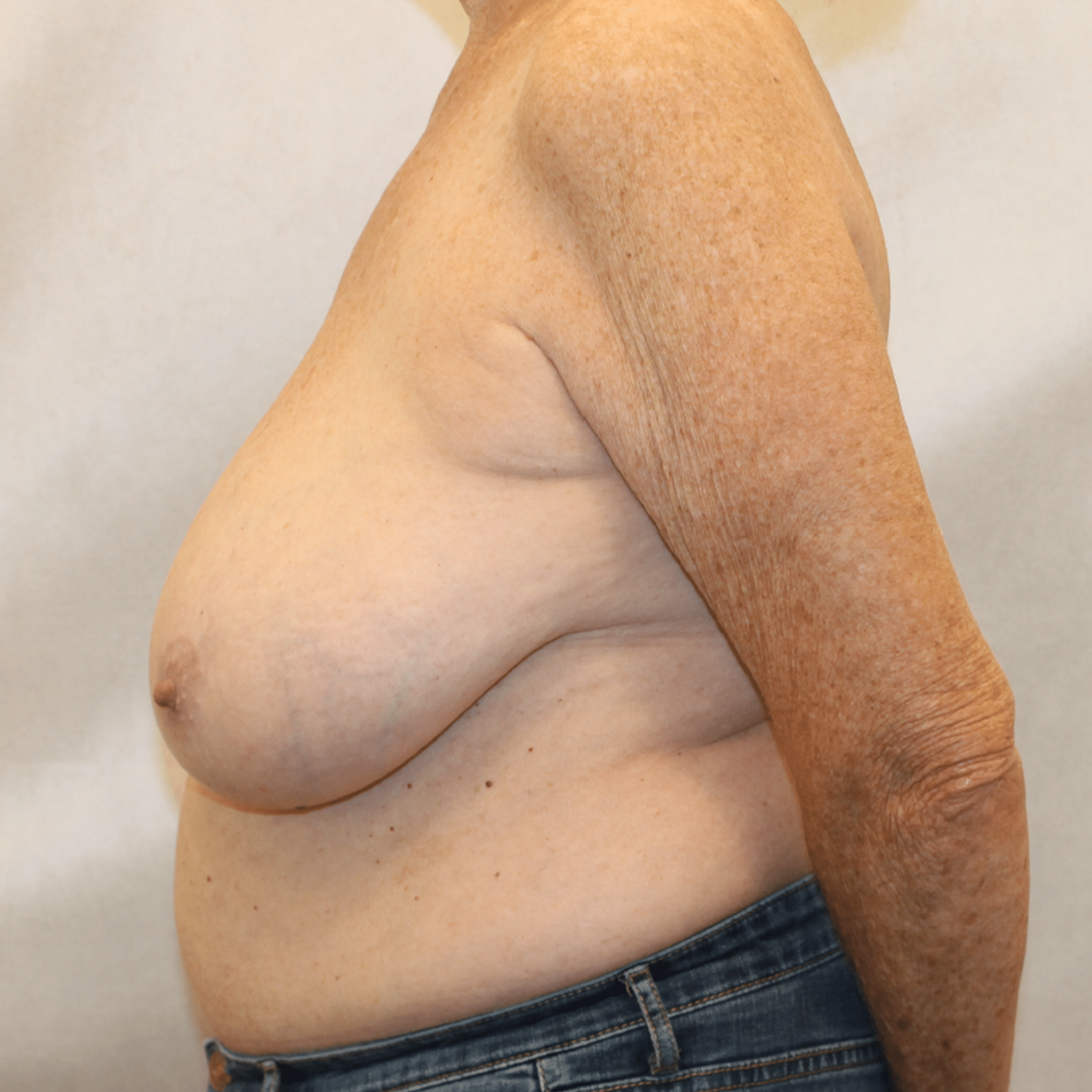 Before Image:  - left-side