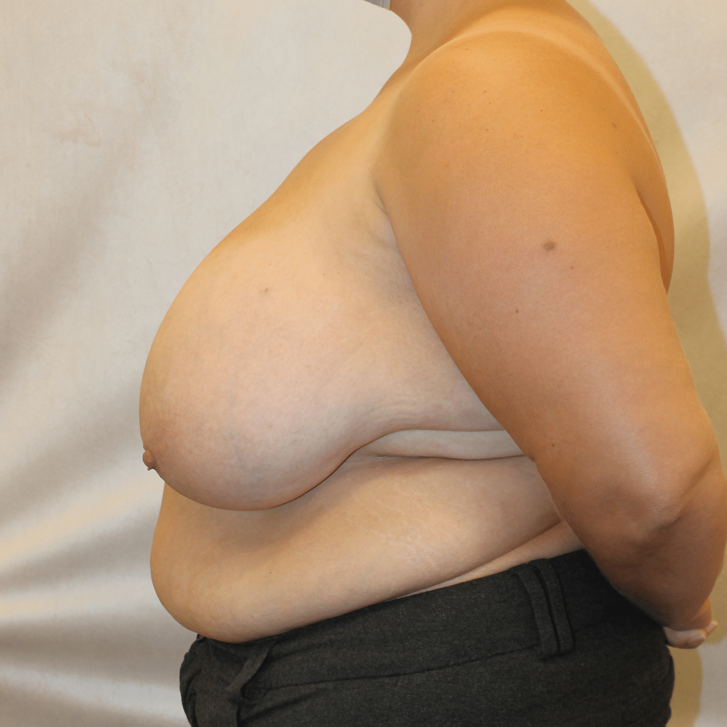 Before Image:  - left-side