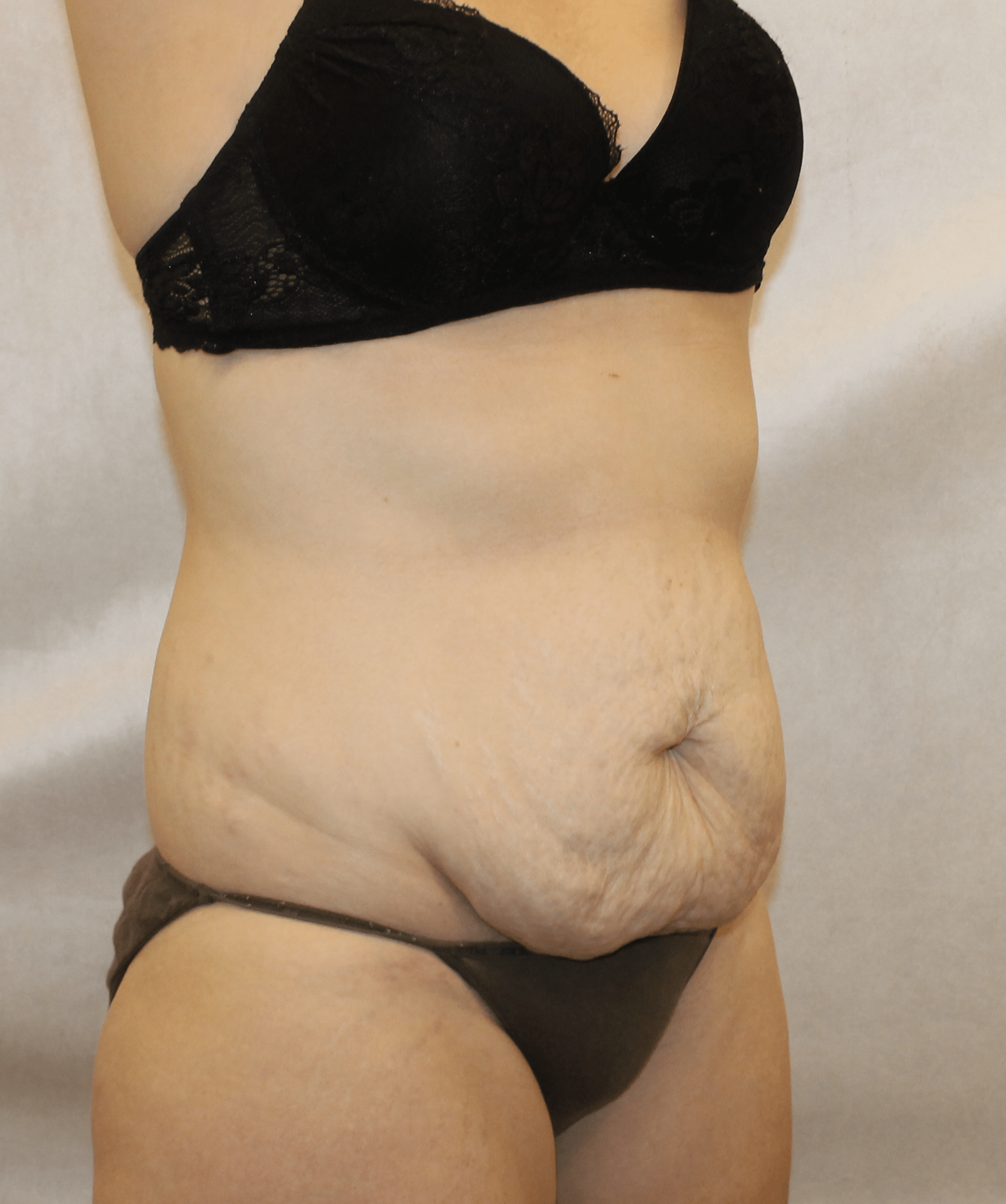 Before Image:  - right-front-oblique